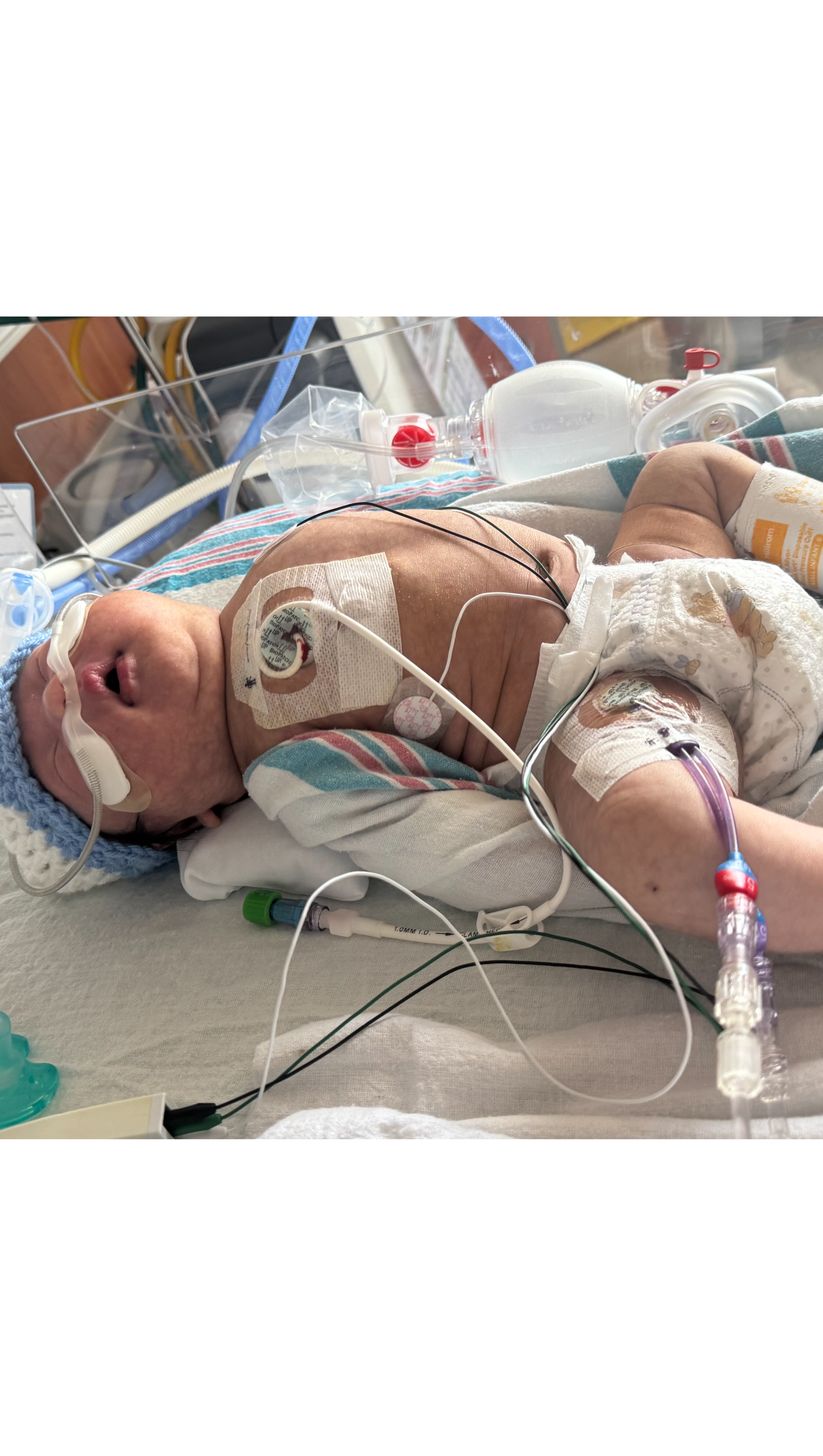Help my newborn battle Leukemia