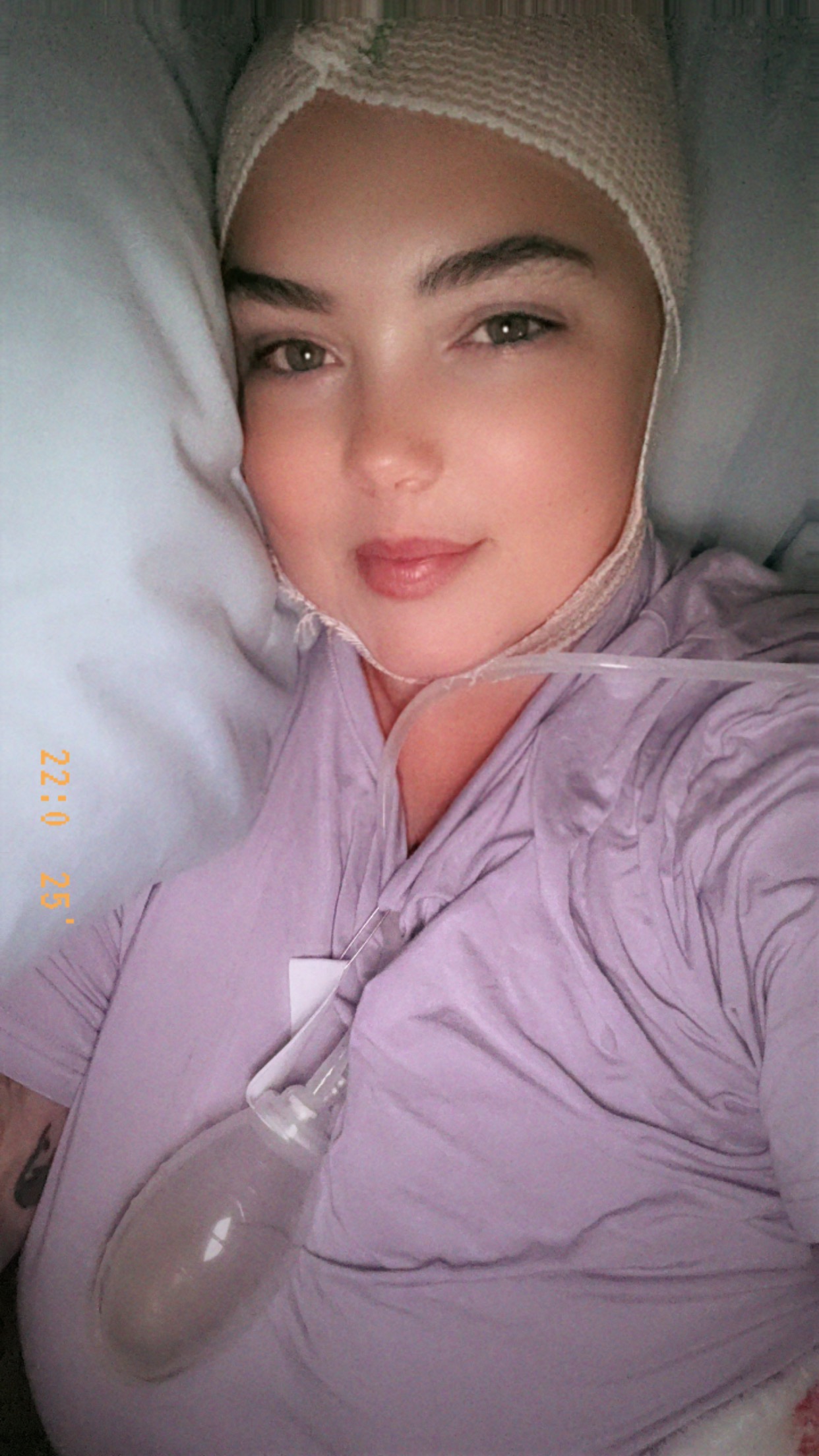 Support for Brain Surgery and Recovery campaign photo, 2 of 8