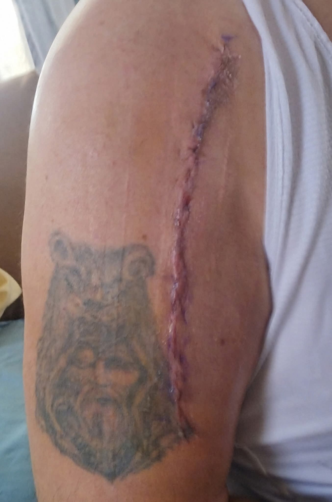 Help with bills due to a serious injury 
Fred Maccarella campaign photo, 2 of 4