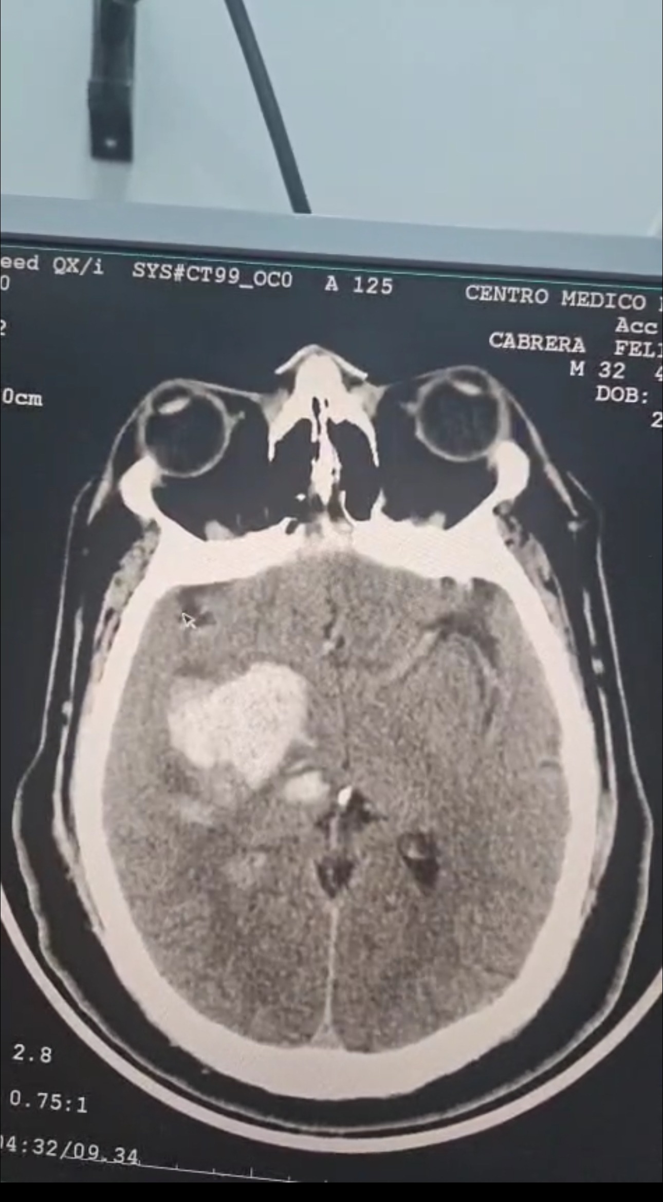 Help Save My Cousin’s Life - Urgent Medical Funds Needed campaign photo, 4 of 8