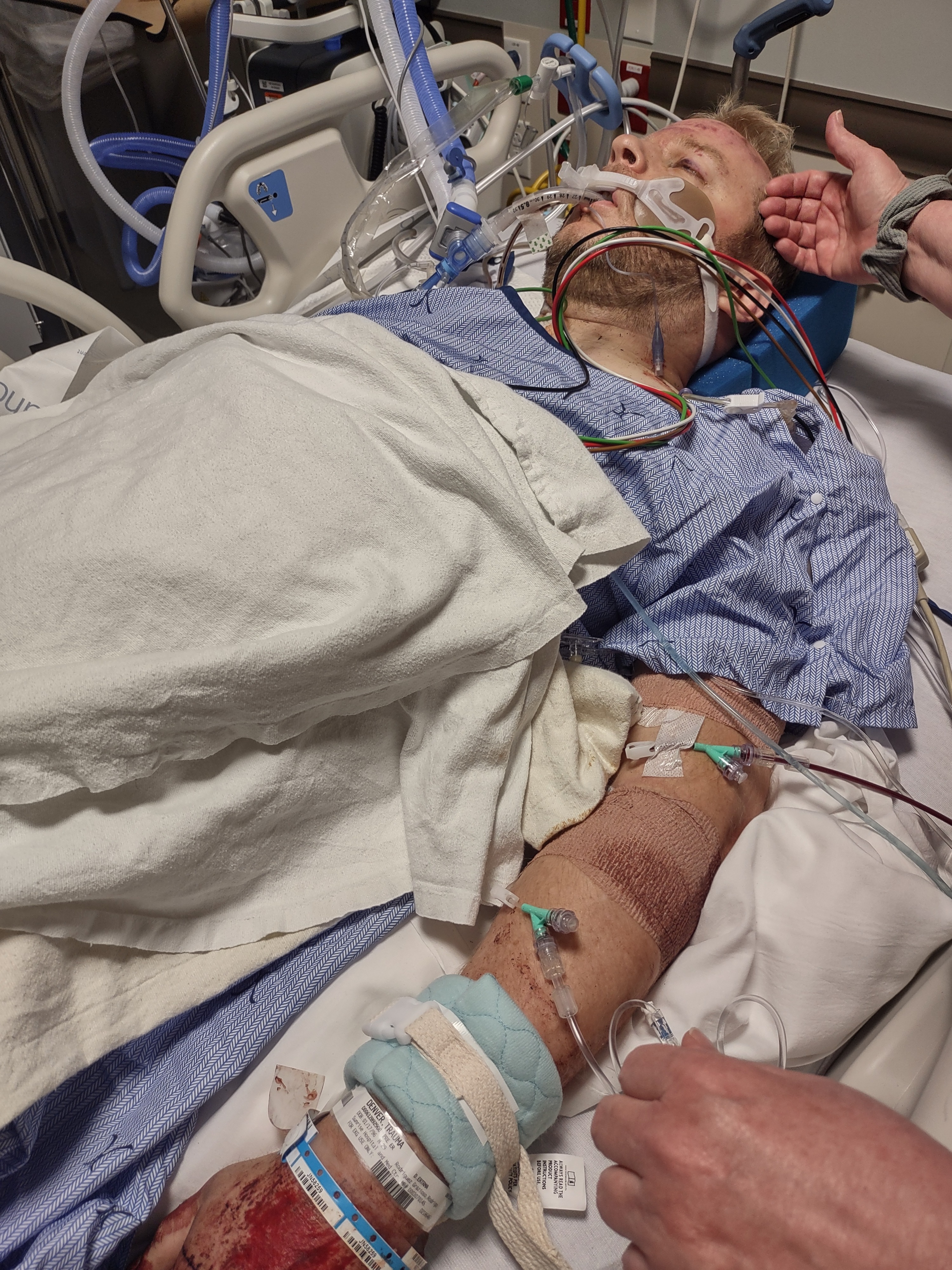 Join Kent's Battle: Cover His ICU Care campaign photo, 4 of 6