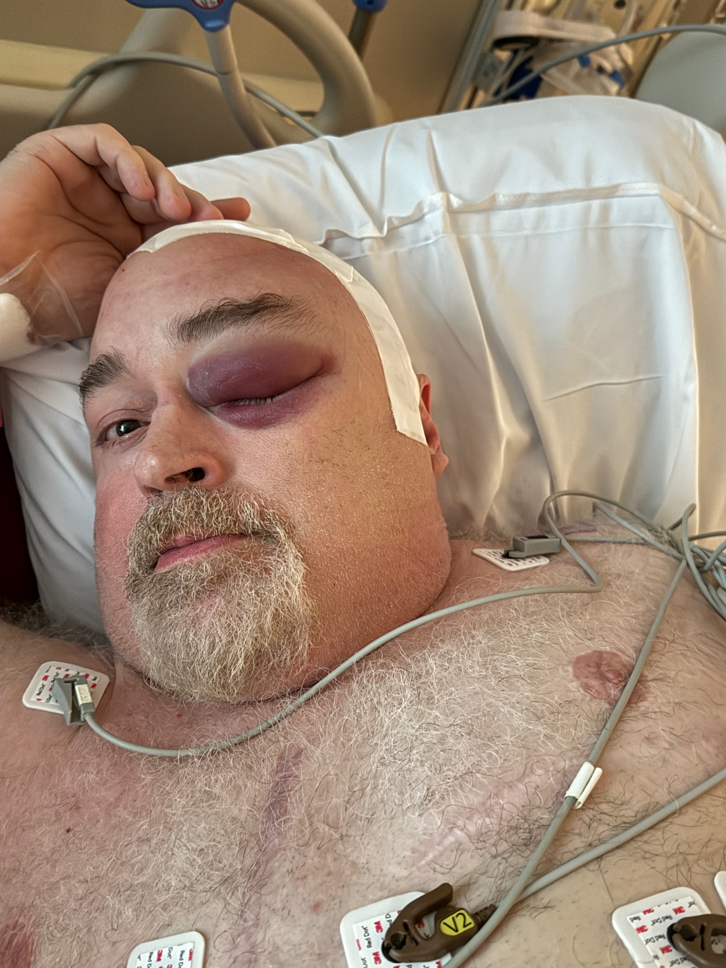 Urgent Aid for Mark's Kenney Brain Surgery campaign photo, 5 of 8