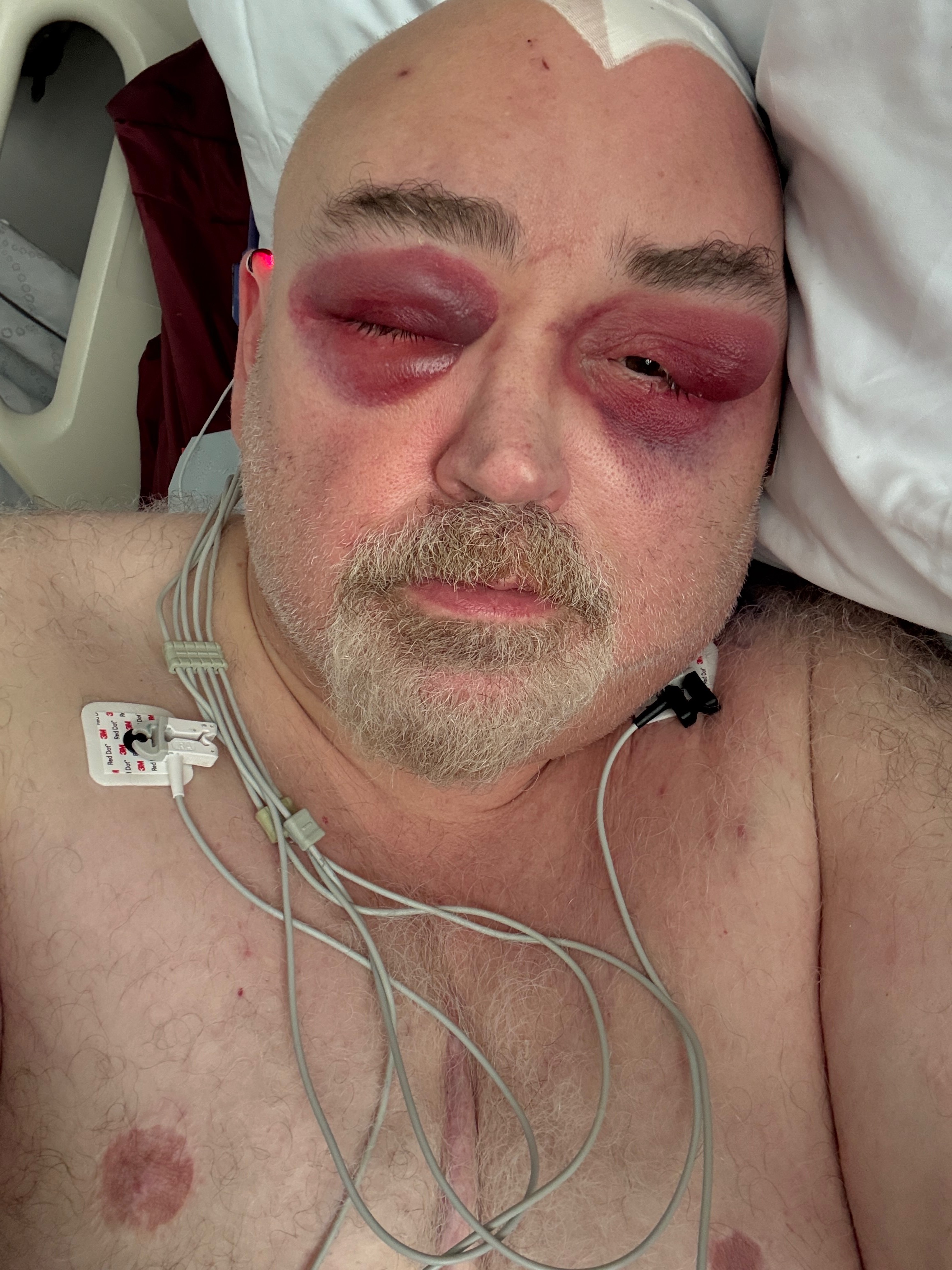 Urgent Aid for Mark's Kenney Brain Surgery campaign photo, 6 of 8
