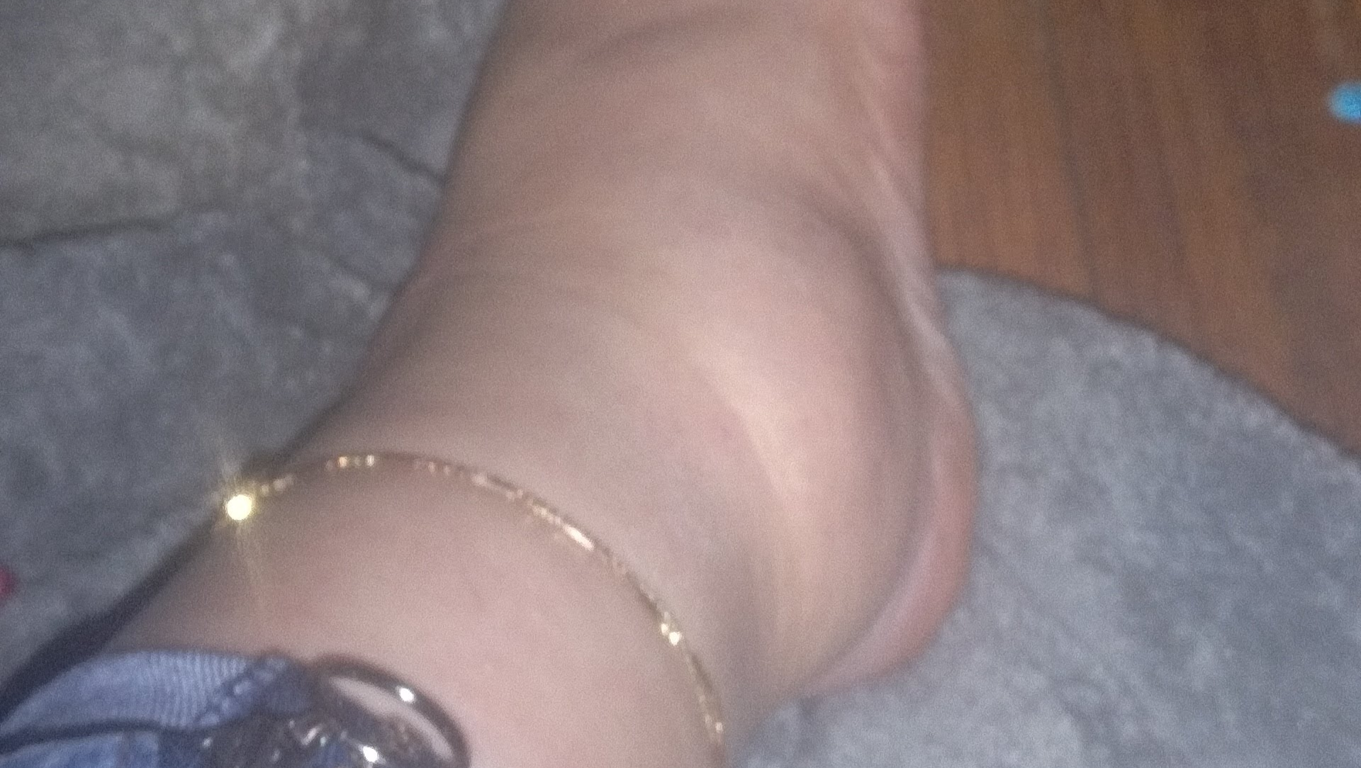 Andrea's Health Crisis: Your Help Needed photo