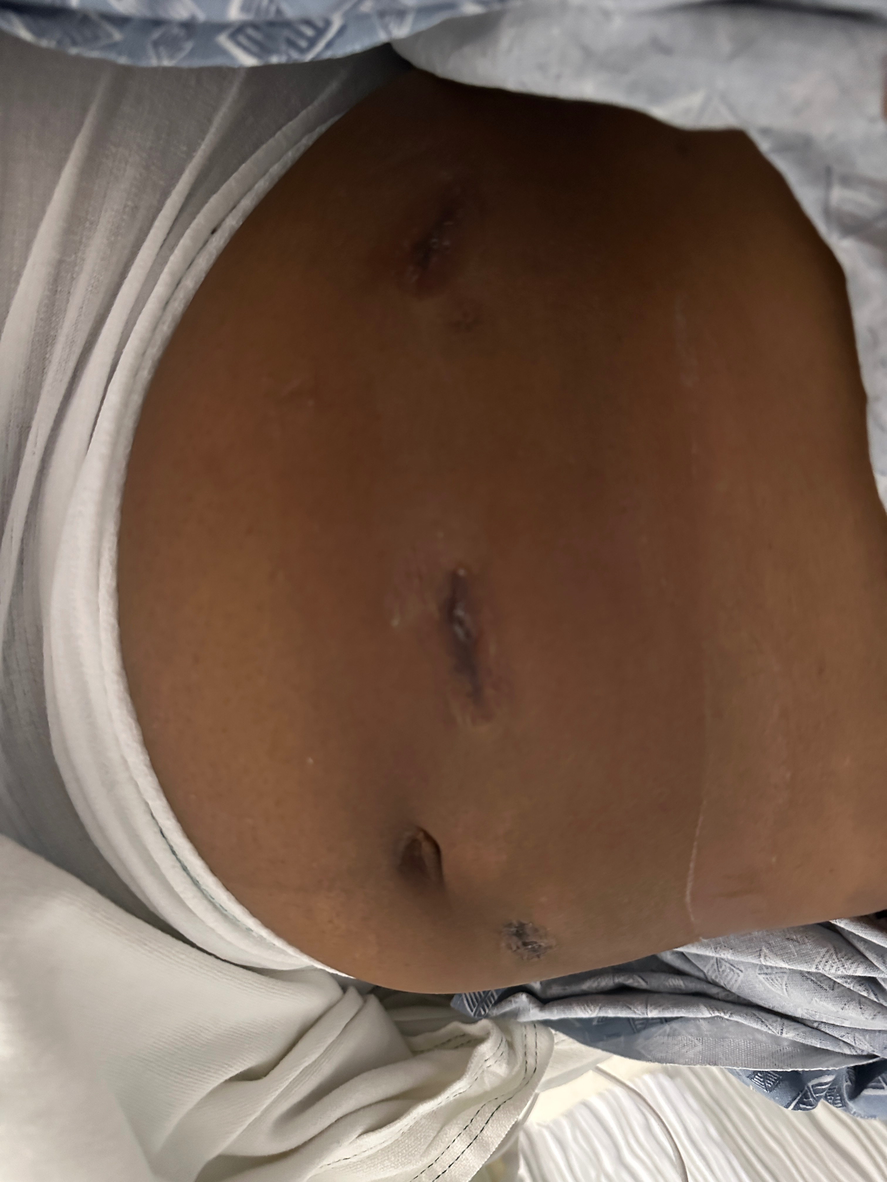 Support Alana's Journey: $6,000 Medical Debt campaign photo, 5 of 6