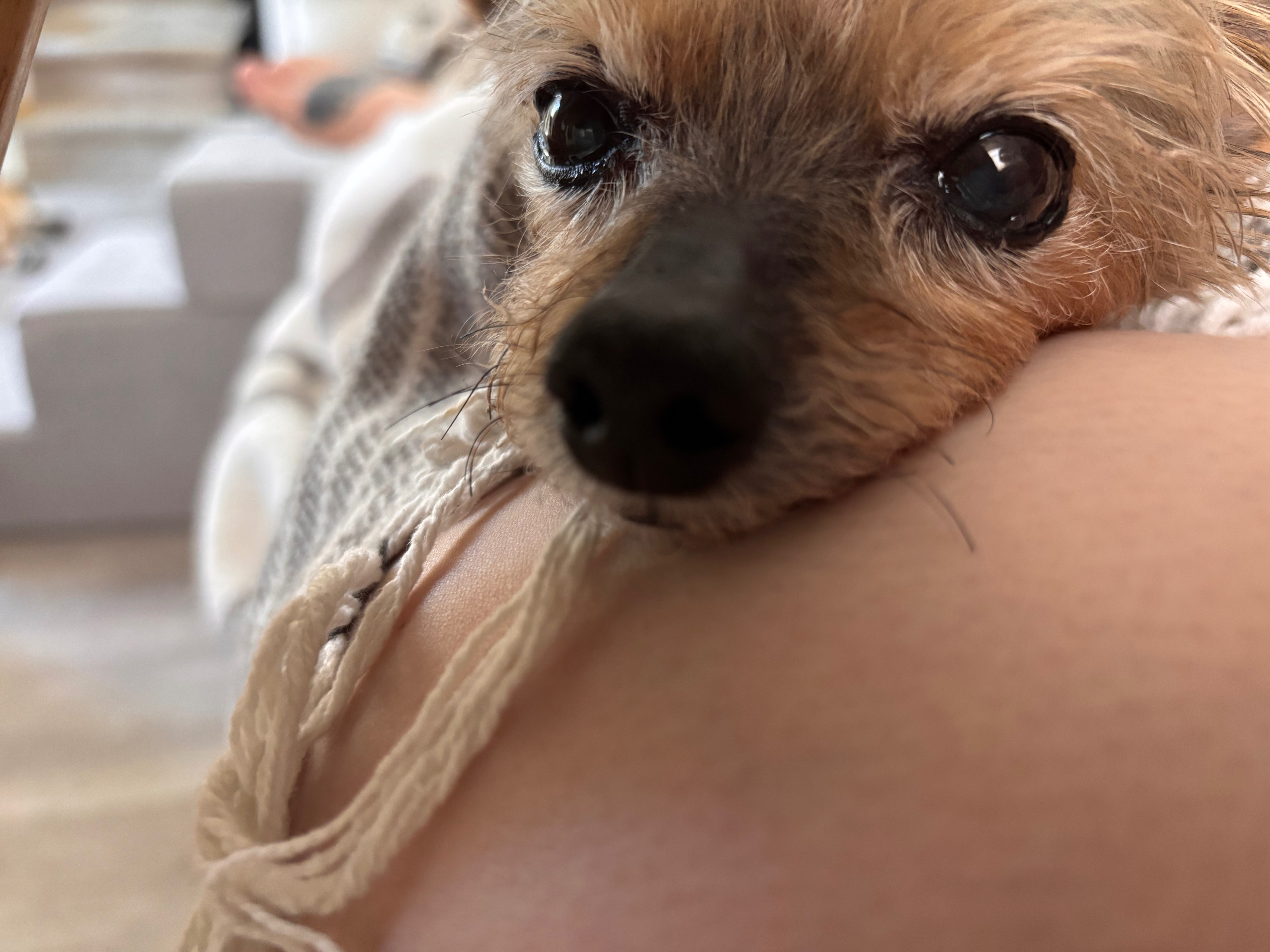Help Aylie Get Urgent Surgery campaign photo, 6 of 8