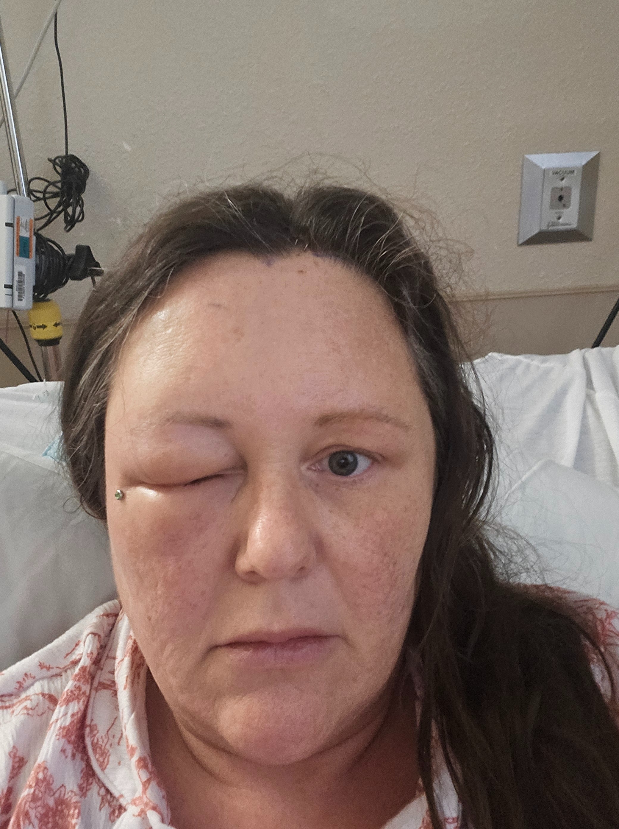 Aid a Mom's Fight After Brain Tumor campaign photo, 7 of 8