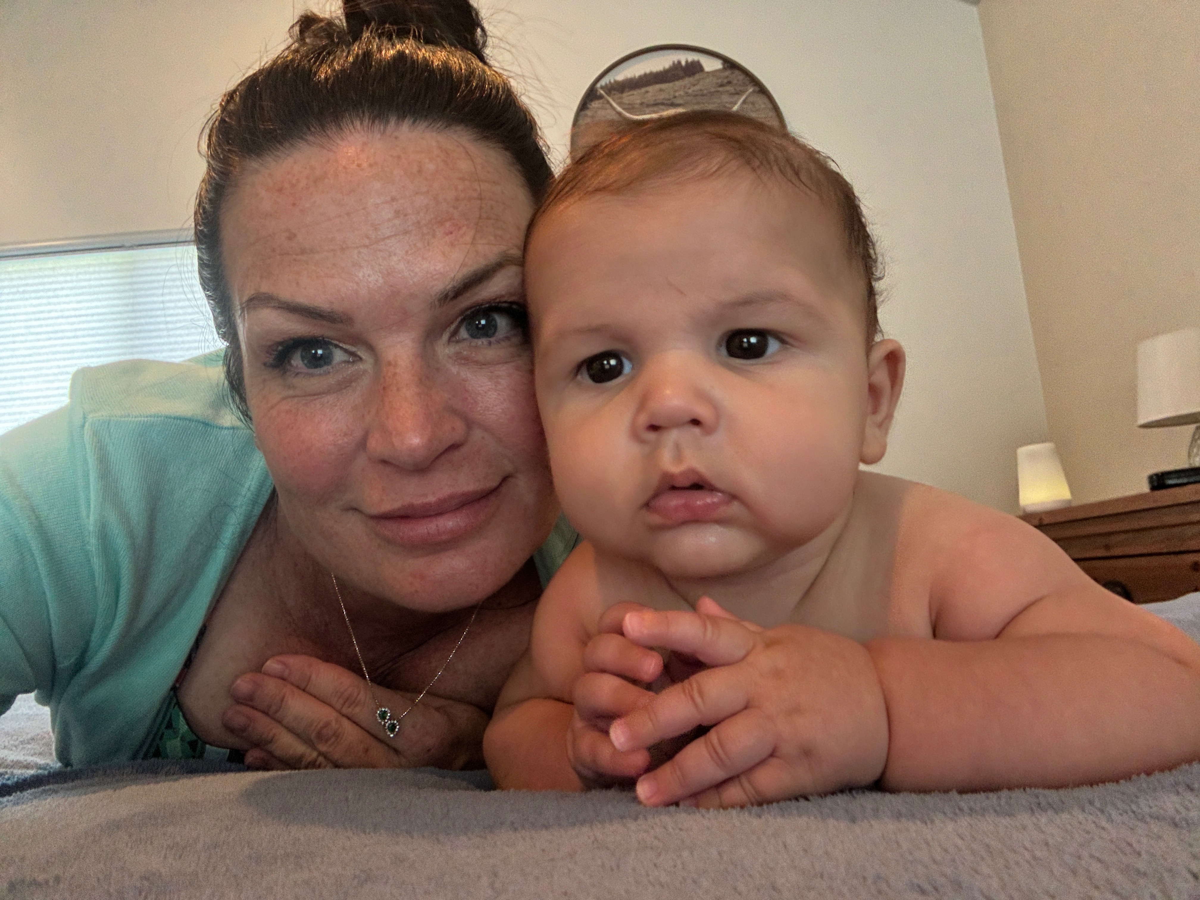 Support Baby Shepherd's Oral Surgery Fund campaign photo, 2 of 4