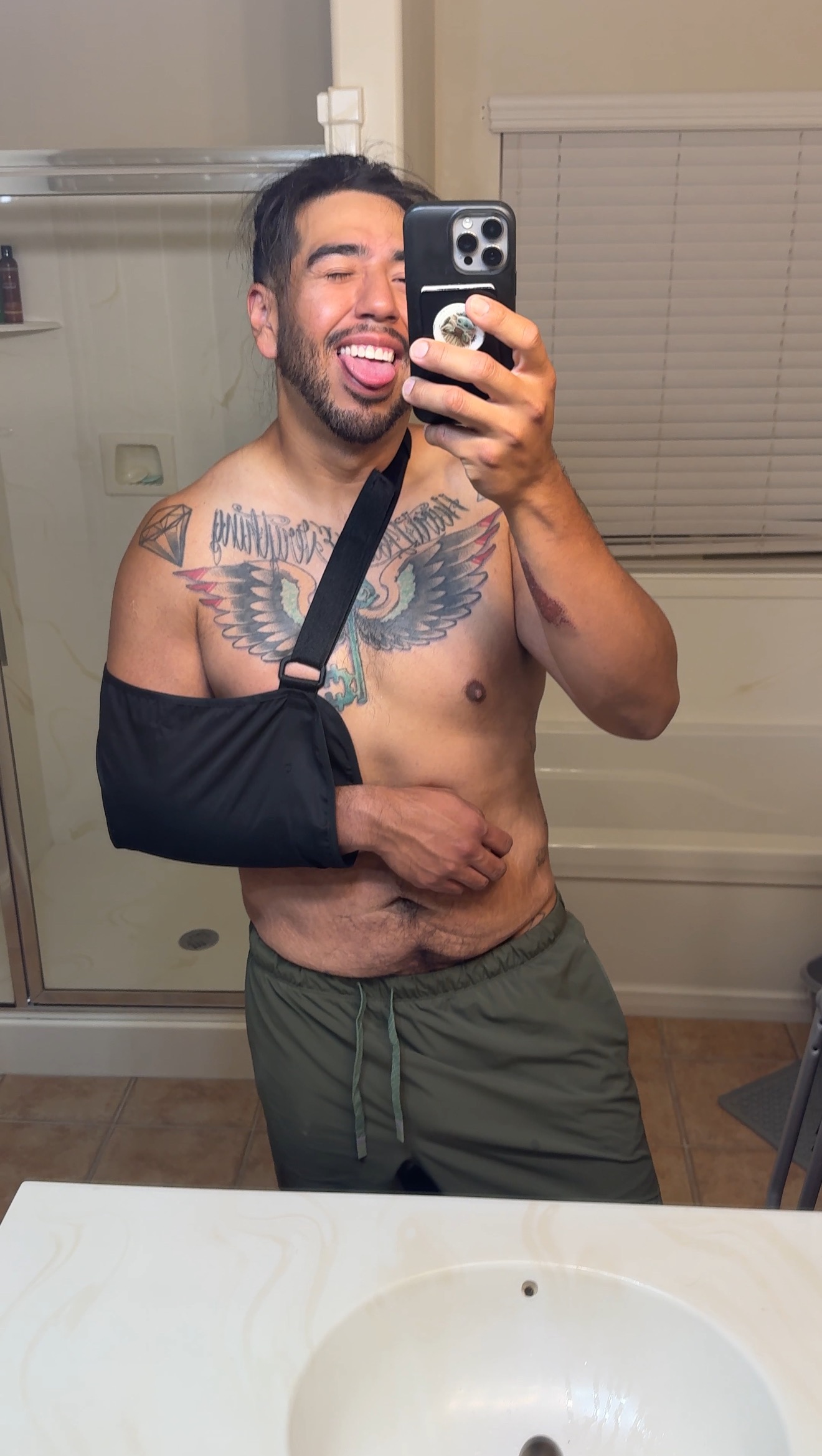 Help Edgar heal after a motorcycle accident campaign photo, 4 of 8