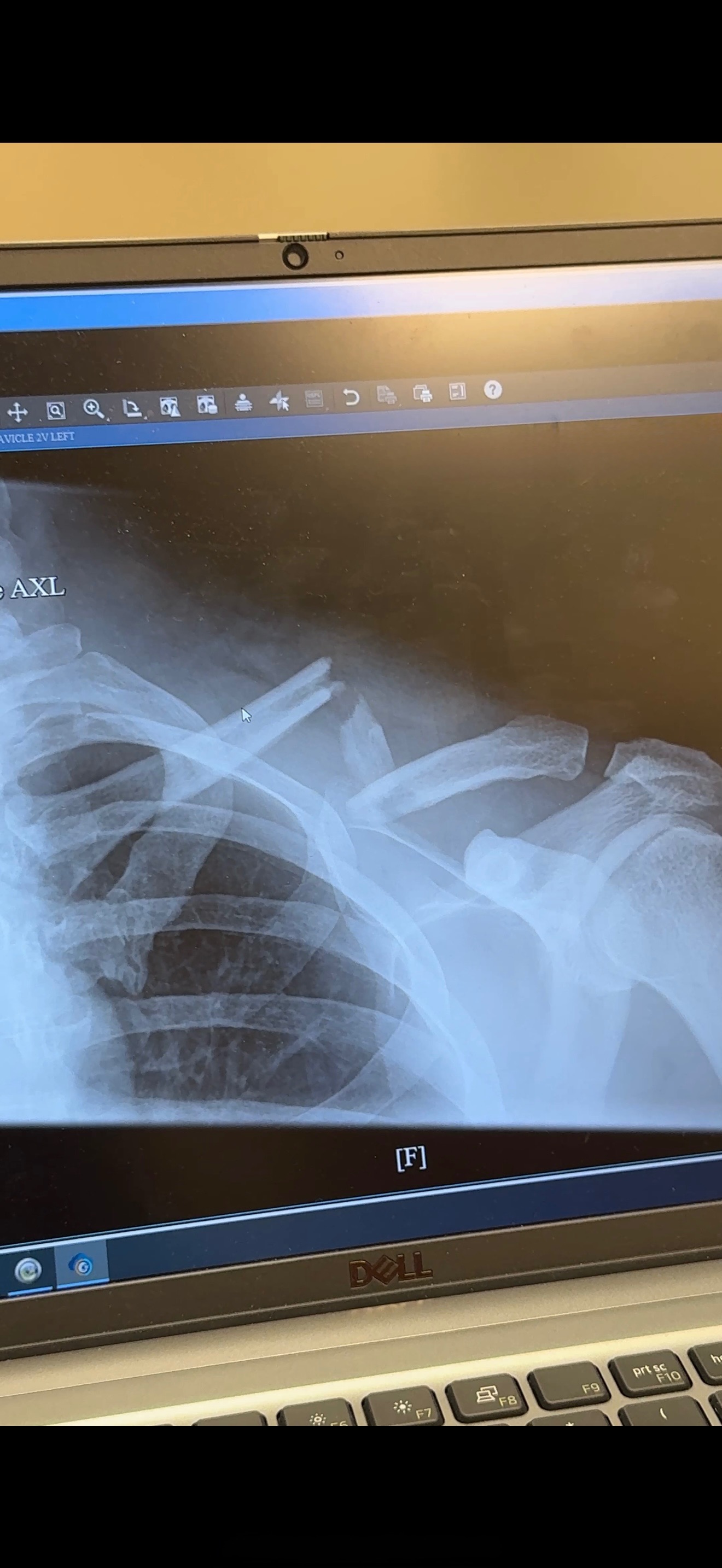 Help Edgar heal after a motorcycle accident campaign photo, 2 of 8