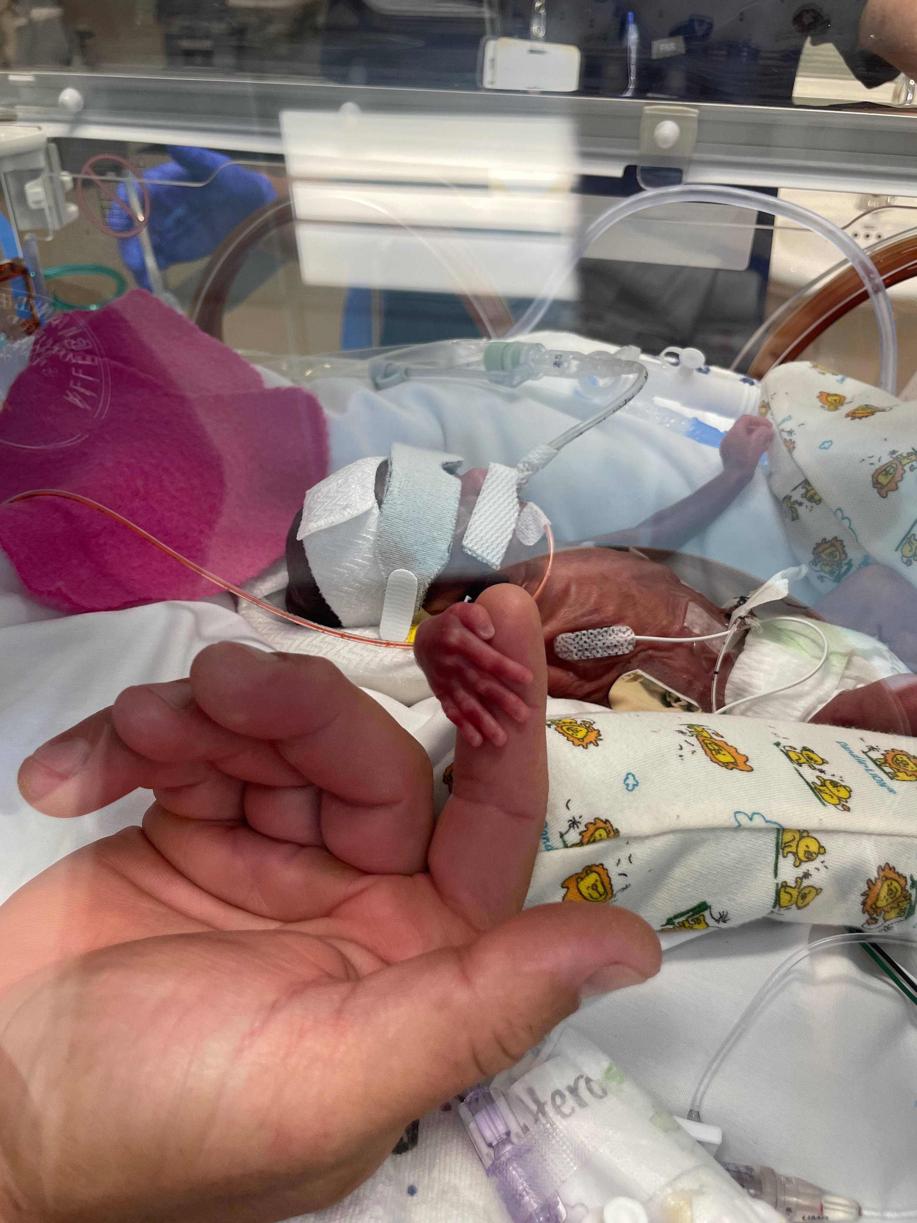 Support Baby Dylan's NICU Journey campaign photo, 7 of 8