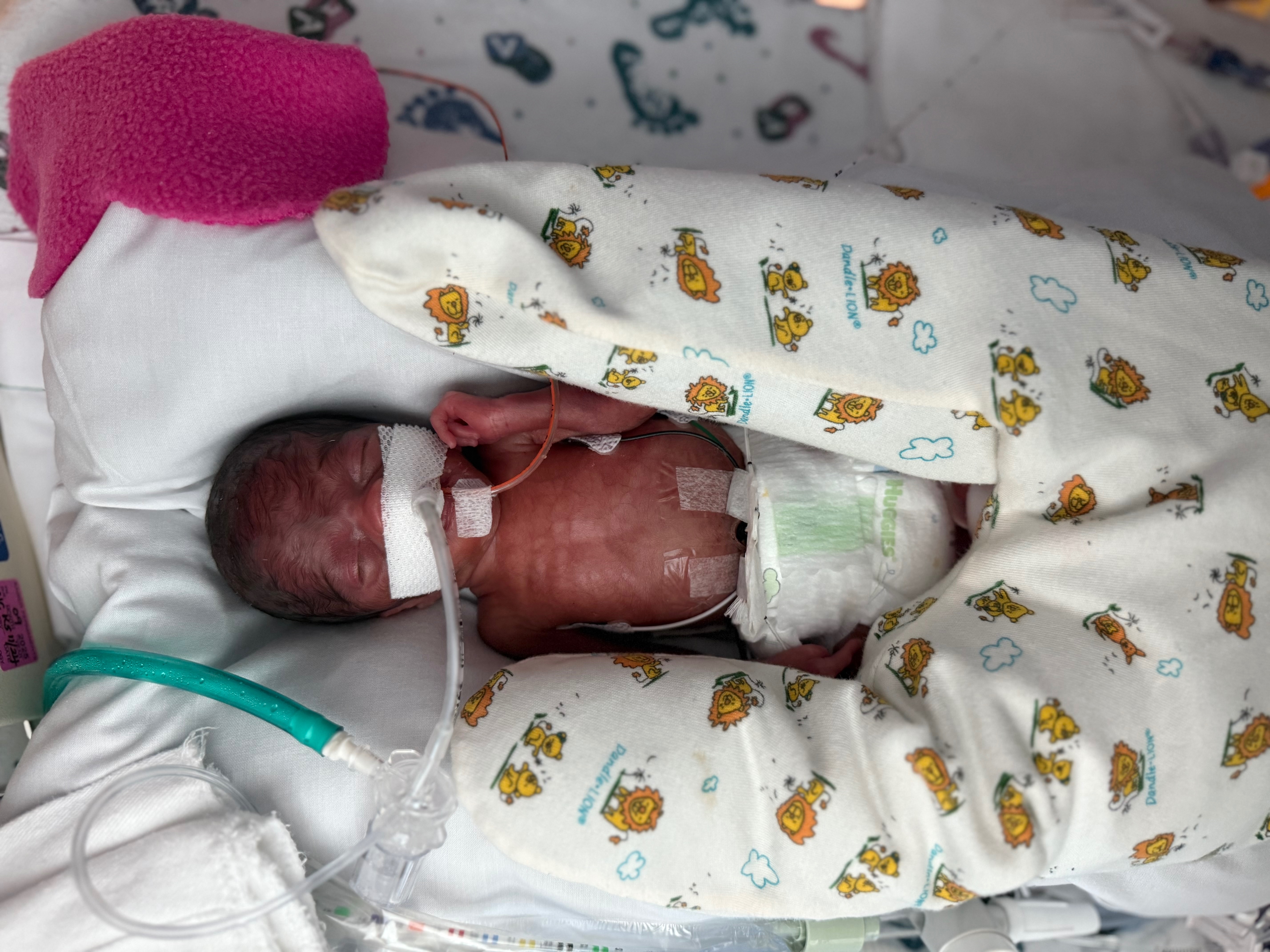 Support Baby Dylan's NICU Journey campaign photo, 4 of 8