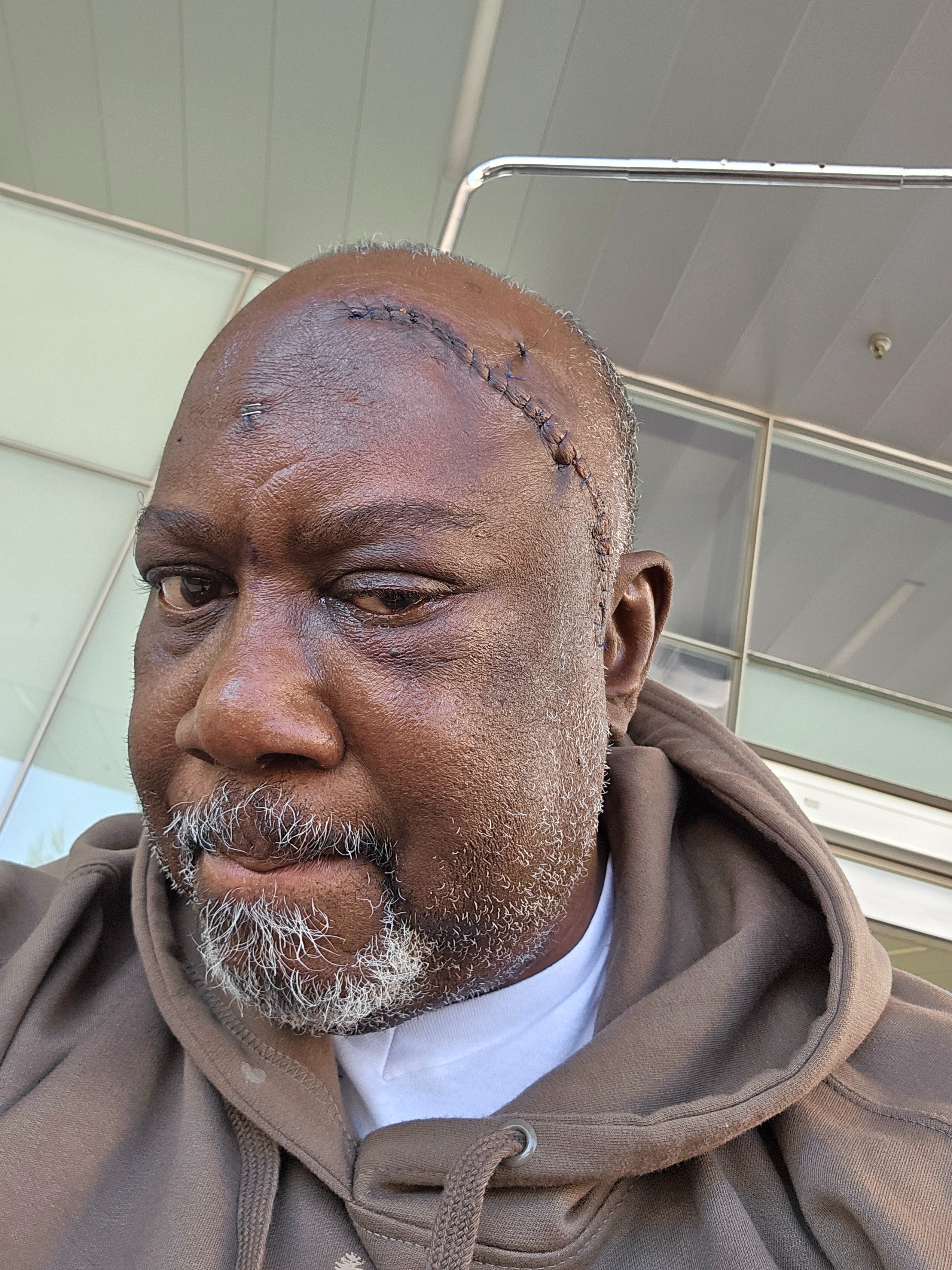 Ted's Urgent Need: Medical Expense Relief campaign photo, 2 of 5