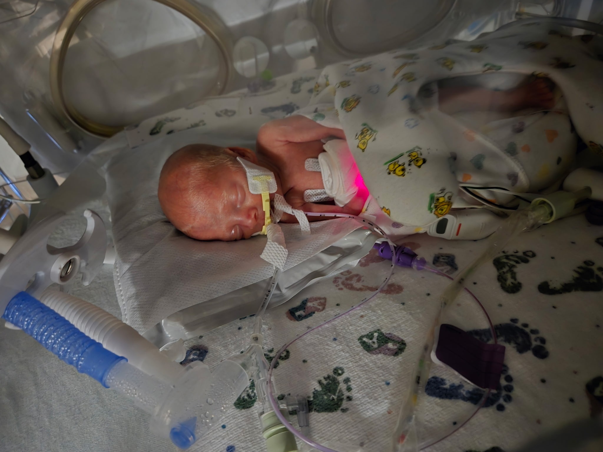 Support Haley and Ben's Miracle Twins campaign photo, 2 of 8