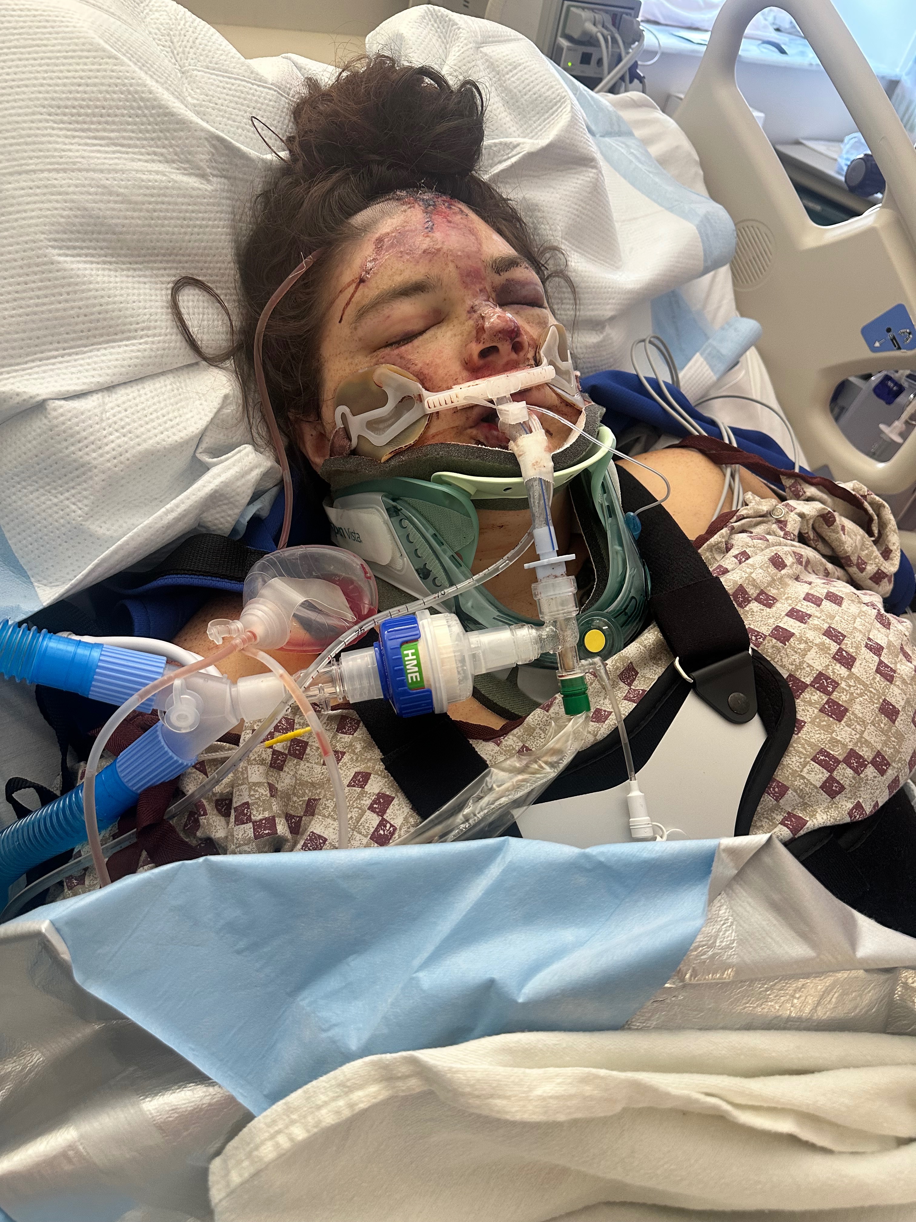 Support Breanna After Devastating Car Crash campaign photo, 2 of 7