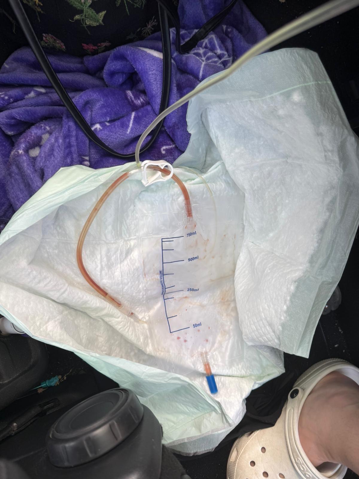 Oobahs blocked bladder campaign photo, 5 of 8