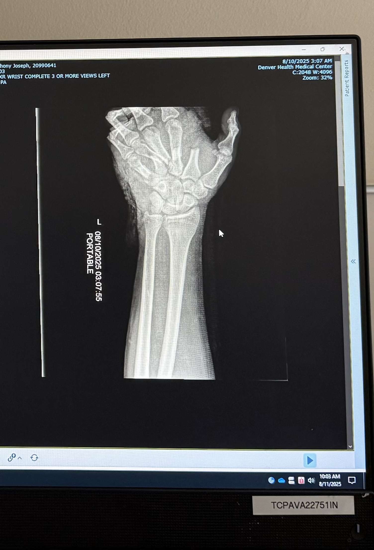 Support Anthony's Journey to Healing and Recovery campaign photo, 4 of 6