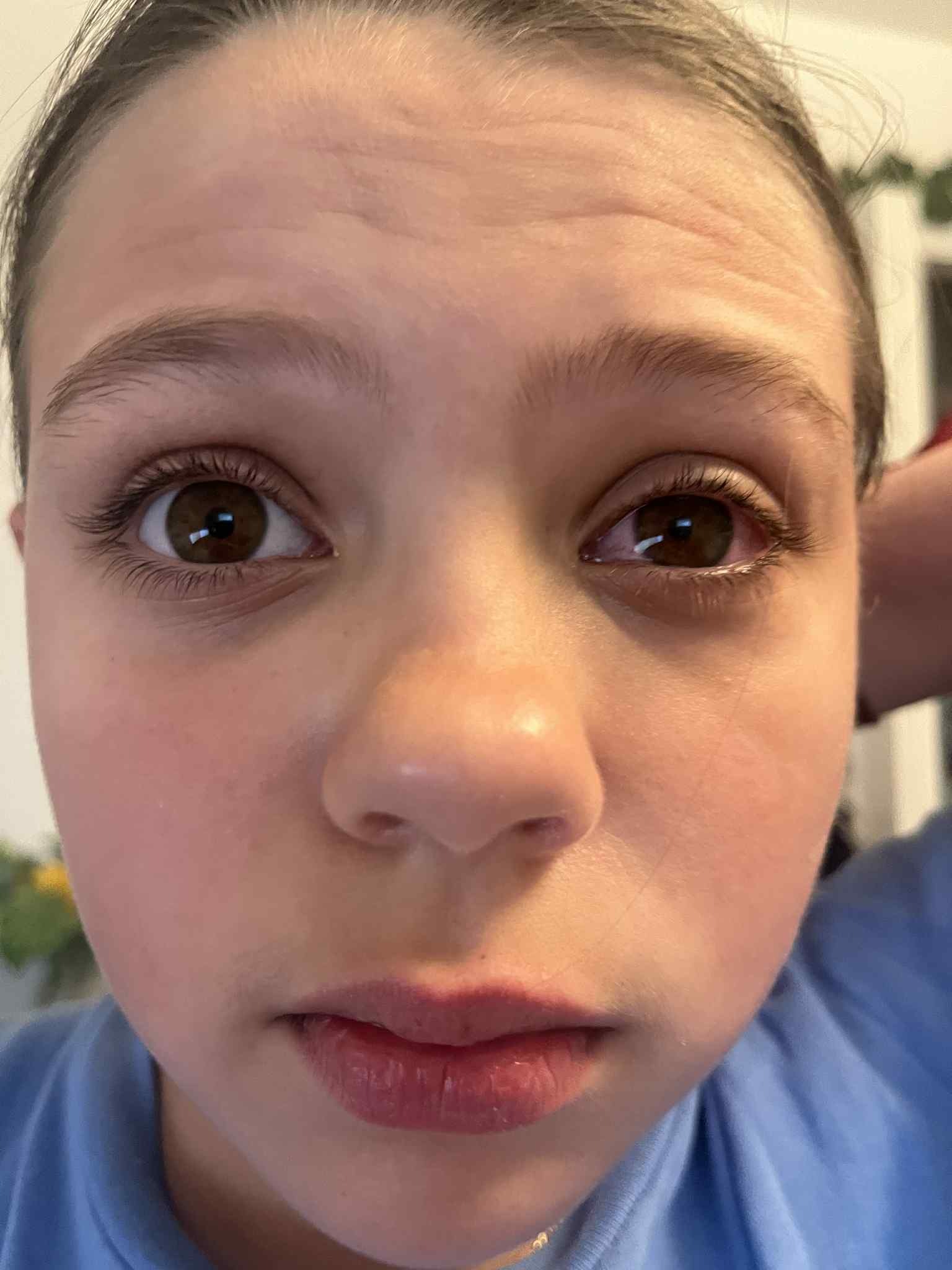 Support Lileigh Copeland's Battle with Cogan's Syndrome campaign photo, 7 of 8