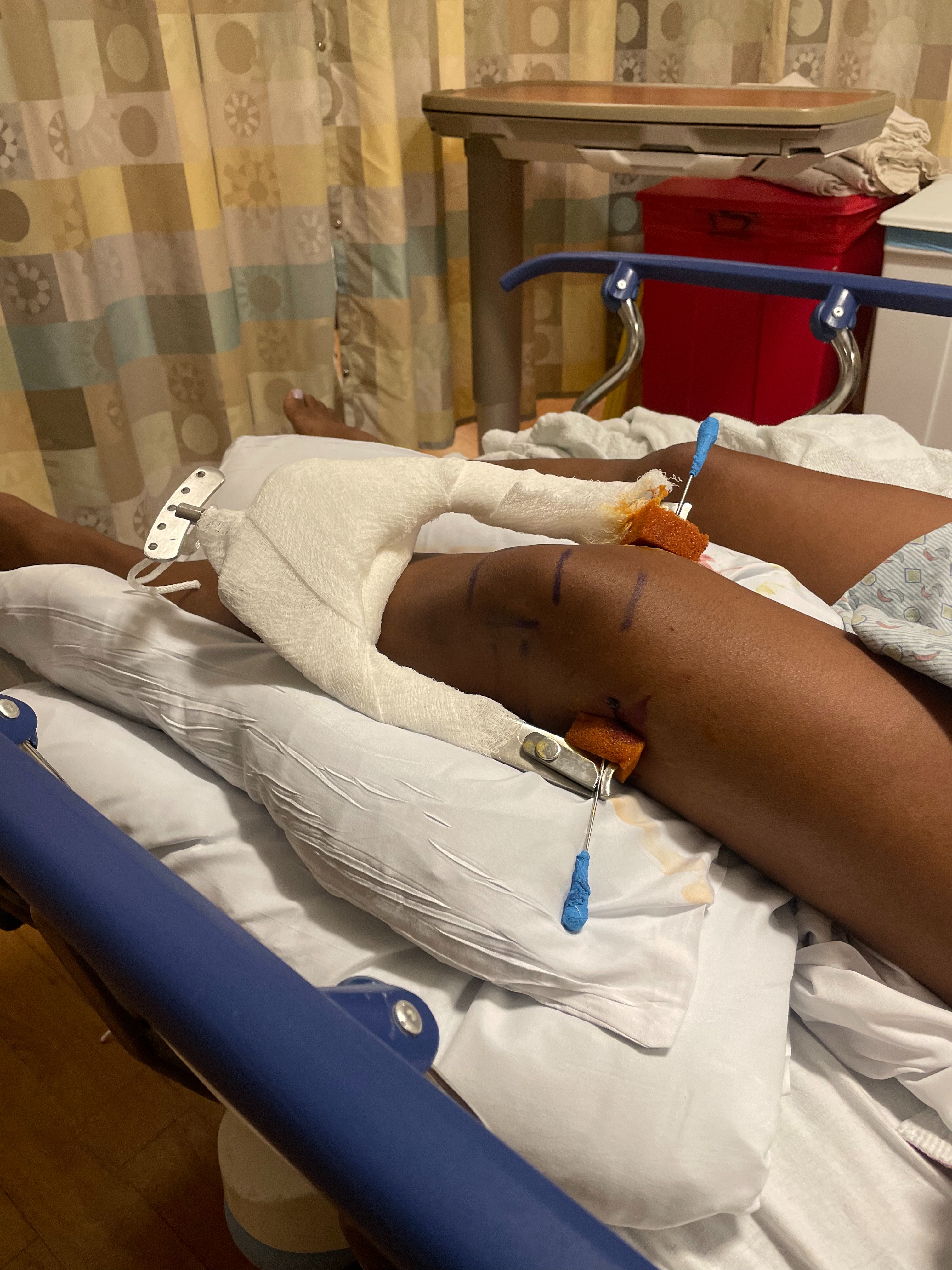 Support Jourdan's Recovery from Traumatic Injuries campaign photo, 4 of 8