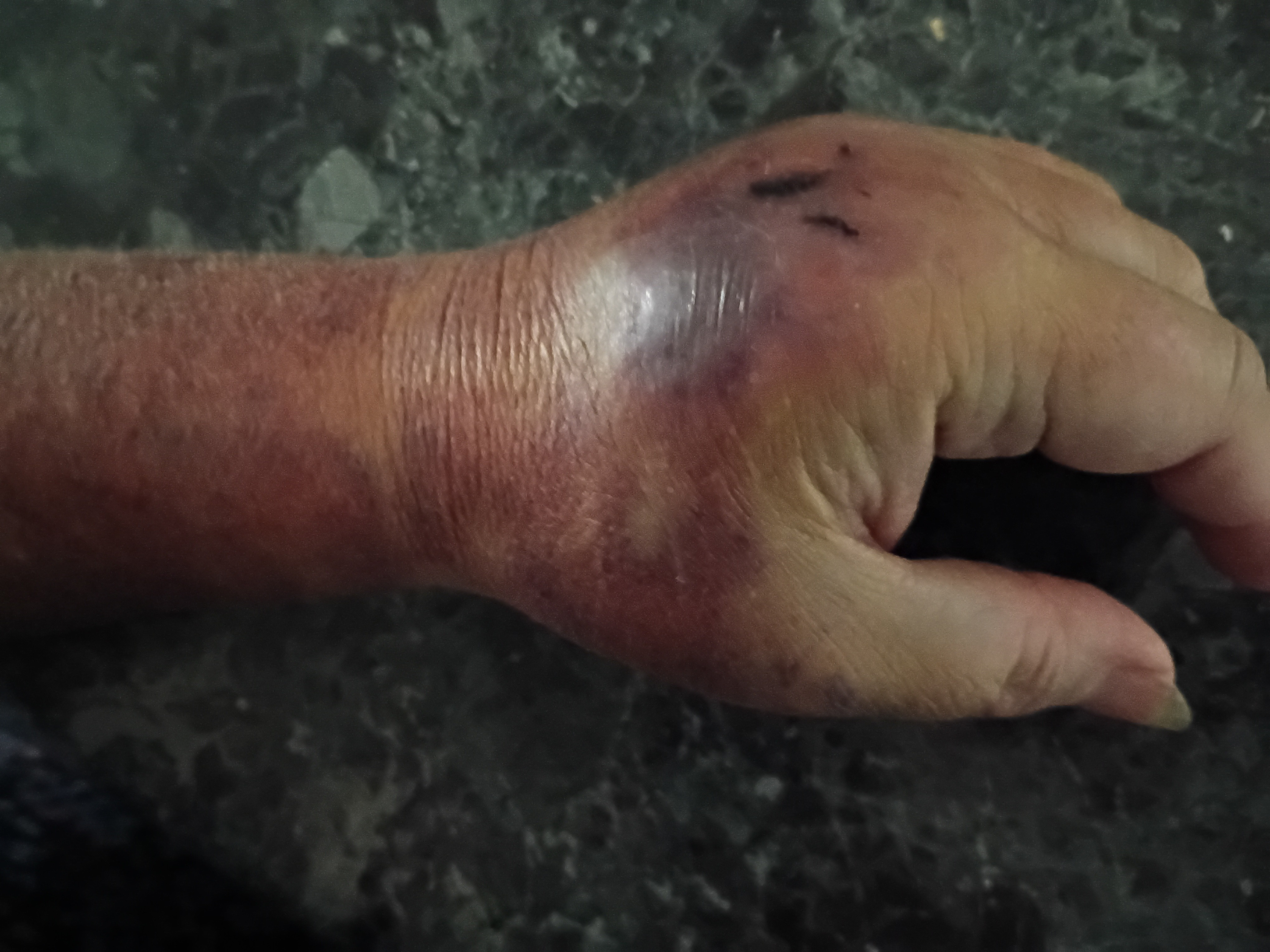 Help Sandra and Her Husband Heal and Recover campaign photo, 7 of 8