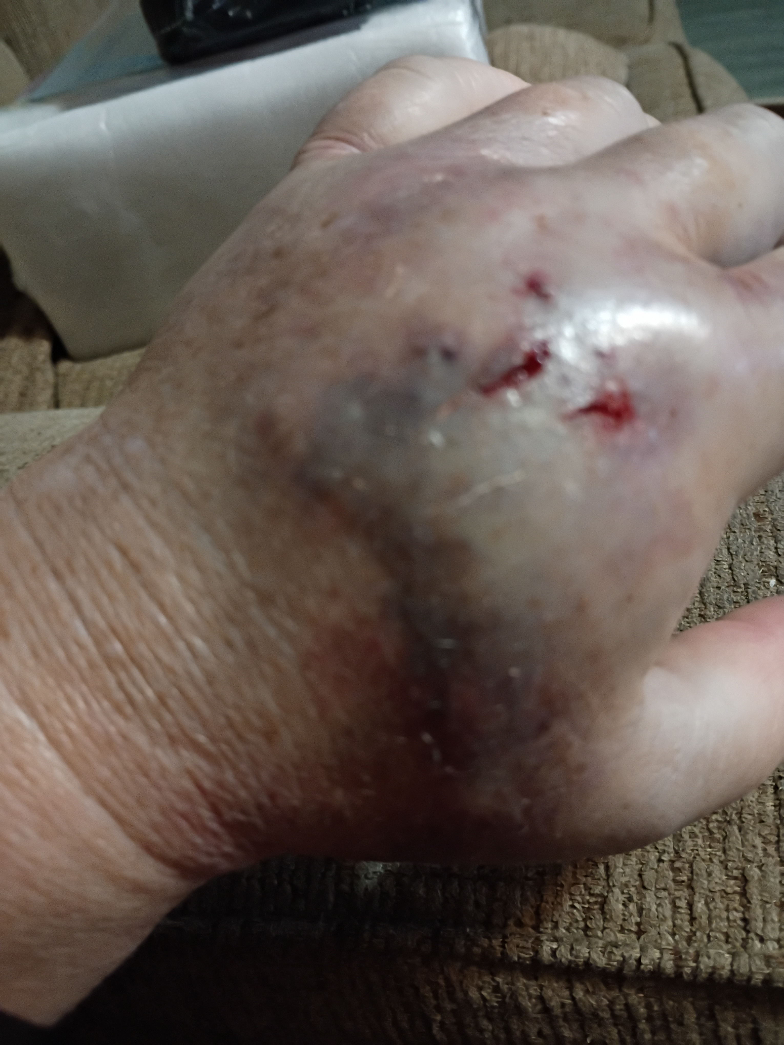 Help Sandra and Her Husband Heal and Recover campaign photo, 2 of 8