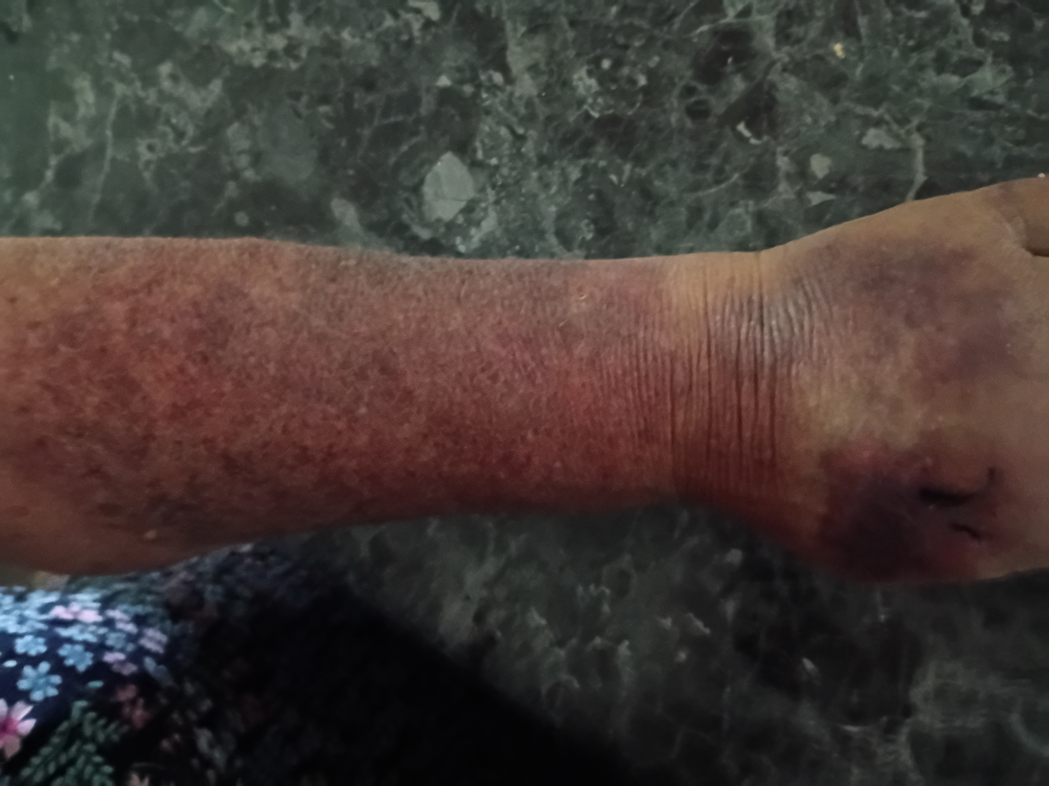Help Sandra and Her Husband Heal and Recover campaign photo, 4 of 8