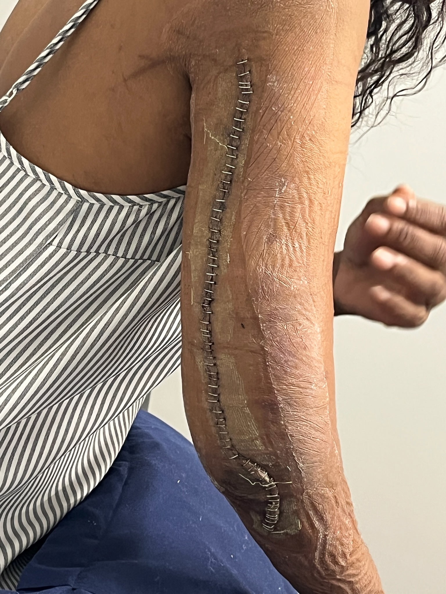 Send love & support - my sister fights to recover campaign photo, 6 of 7