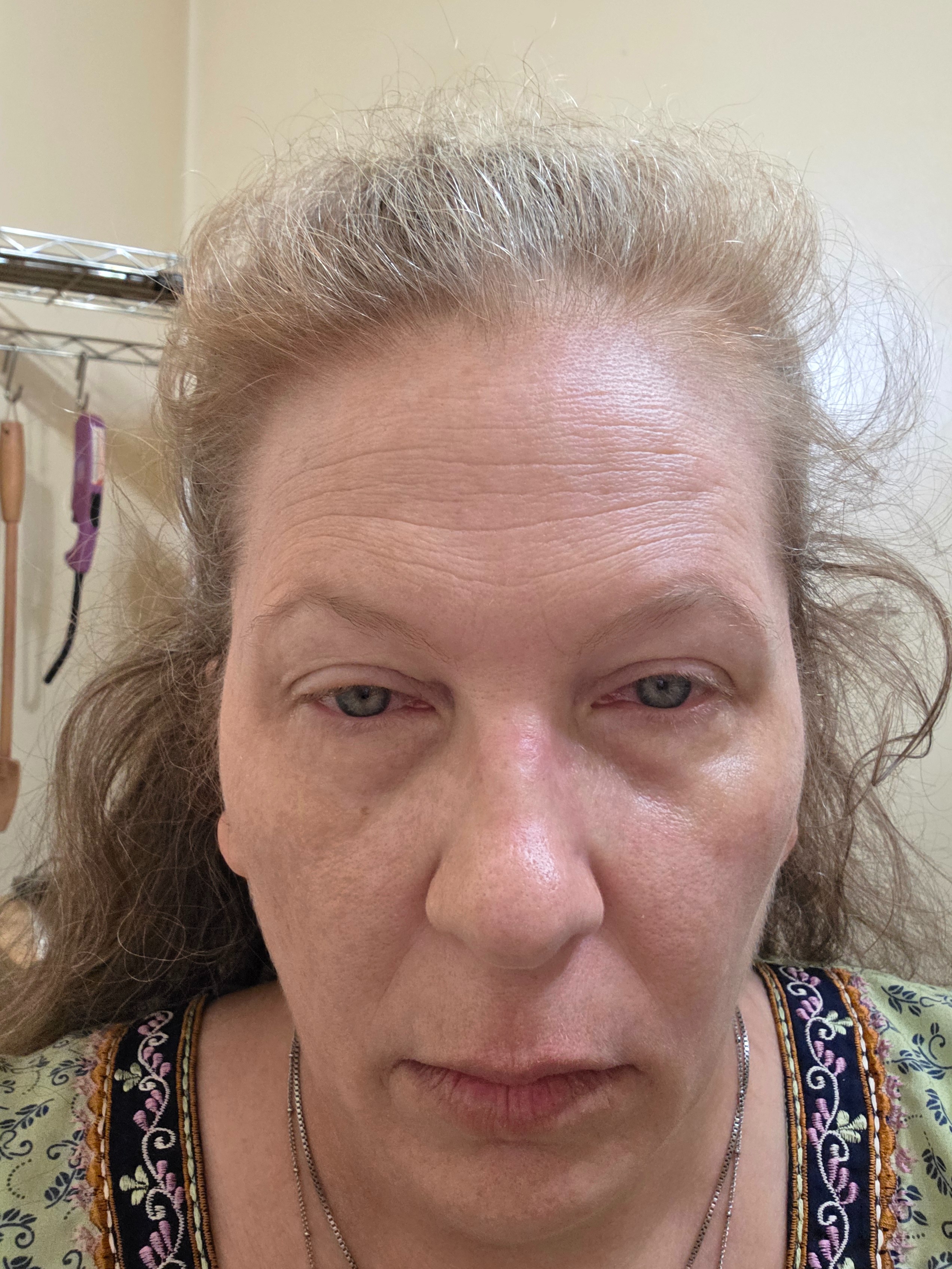 Support Margaret's Caregiving Journey, keep her housed! campaign photo, 2 of 8
