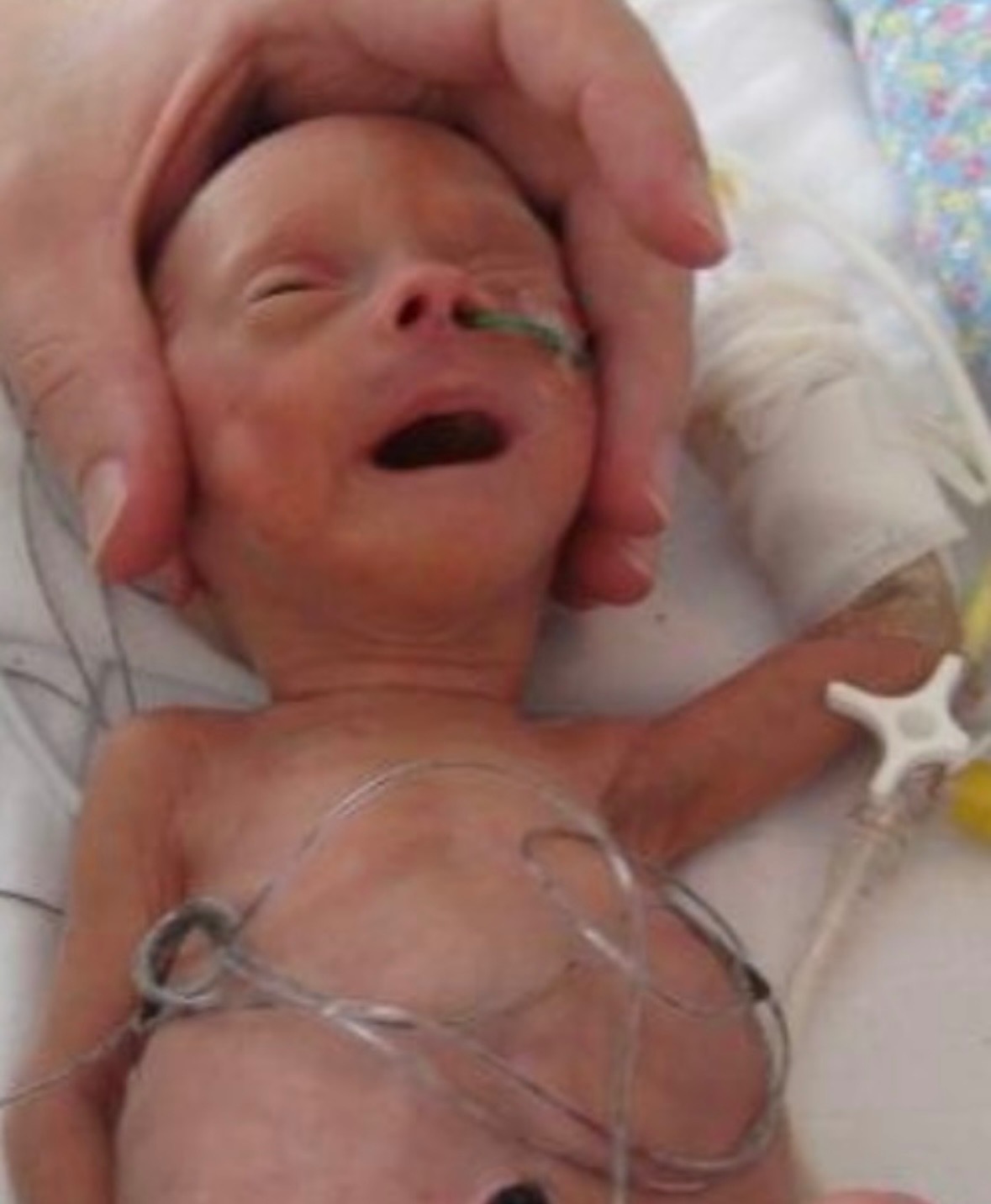 Kampagnen-Foto für Ein Leben voller Hoffnung – Hilfe für kleine Kämpfer, 6 von 7
