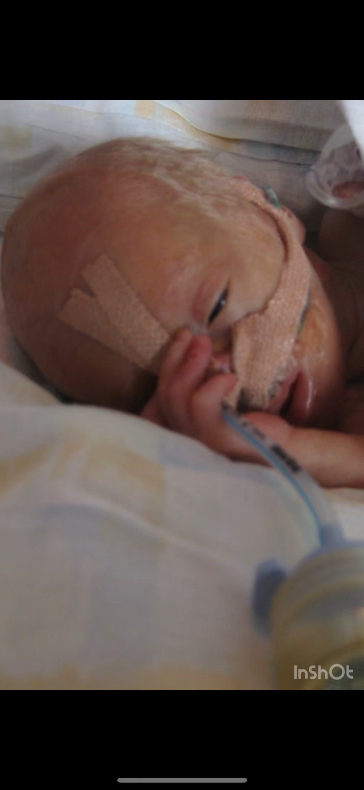 Kampagnen-Foto für Ein Leben voller Hoffnung – Hilfe für kleine Kämpfer, 2 von 7