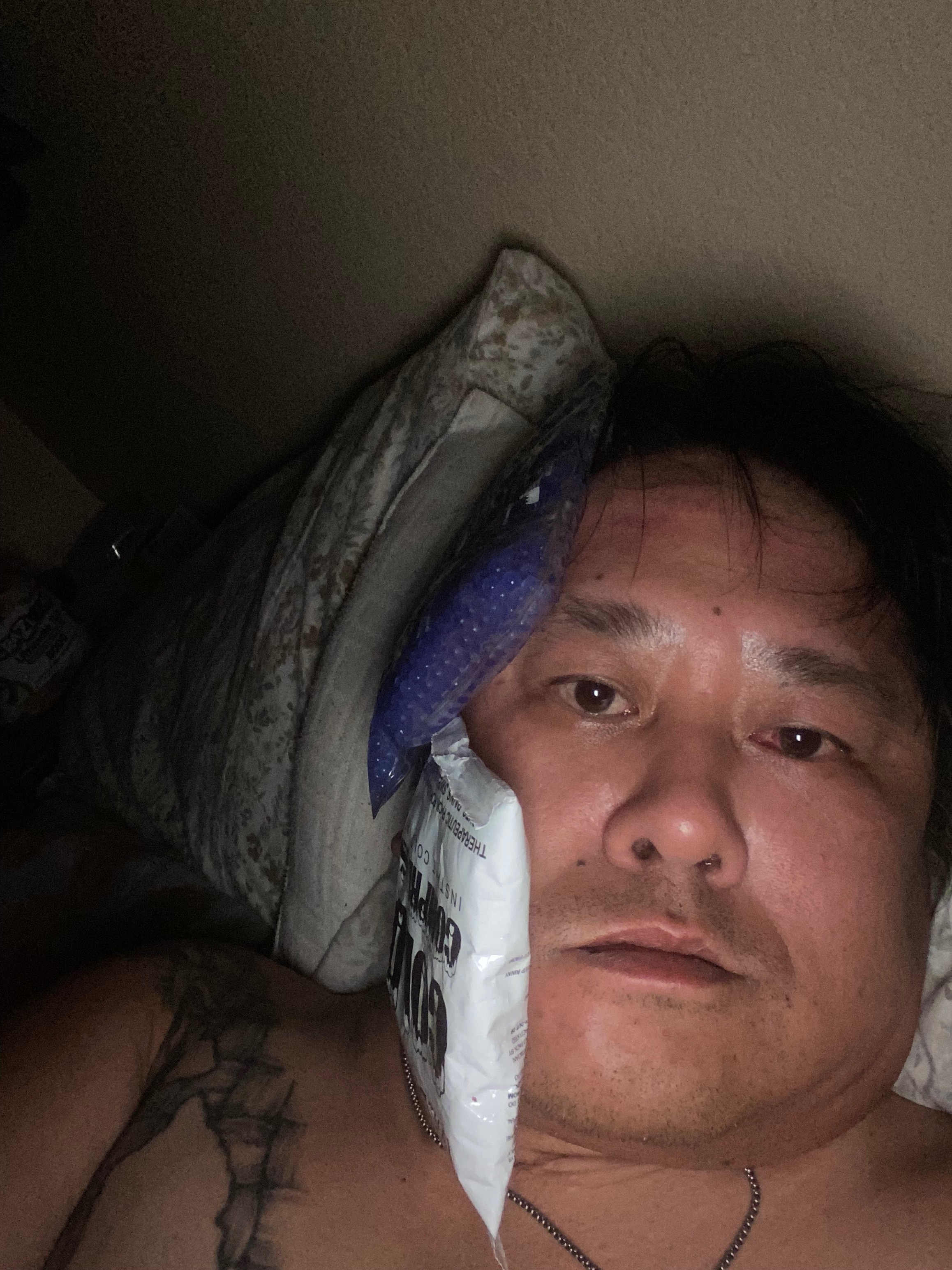 Ryen Needs Help After Being Assaulted campaign photo, 4 of 7