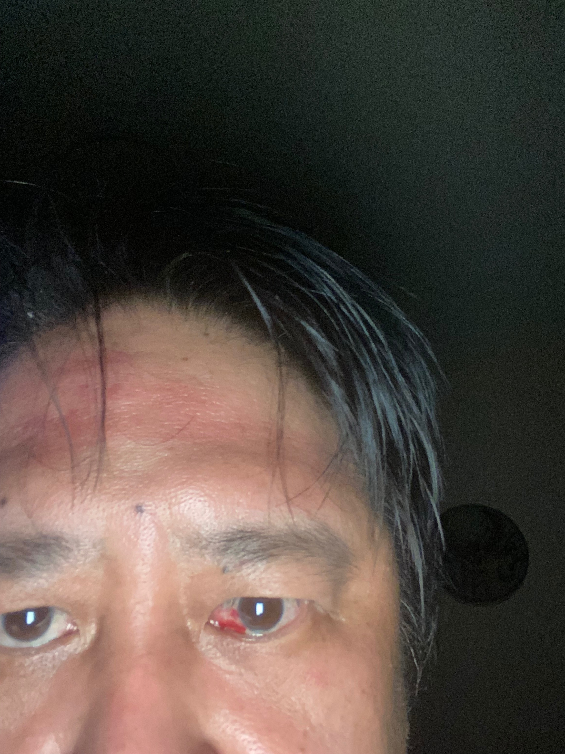 Ryen Needs Help After Being Assaulted campaign photo, 2 of 7