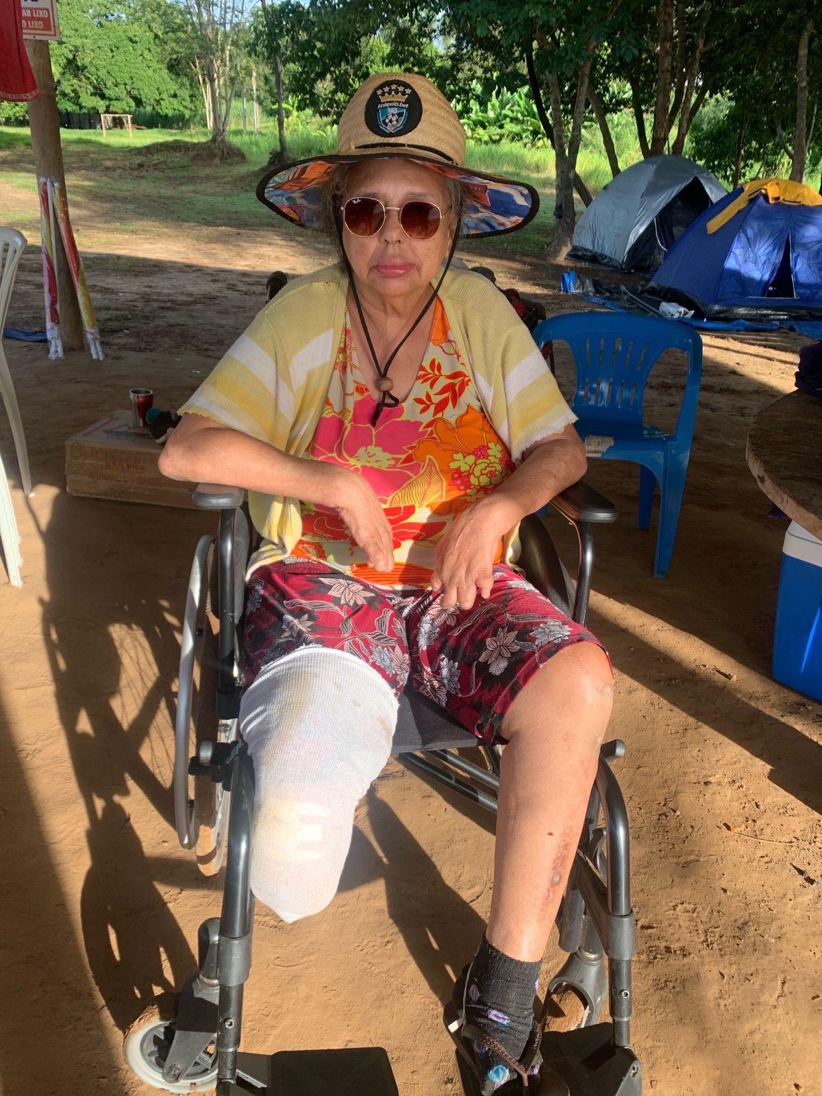 Help Maria Walk Again with a Prosthesis campaign photo, 2 of 4