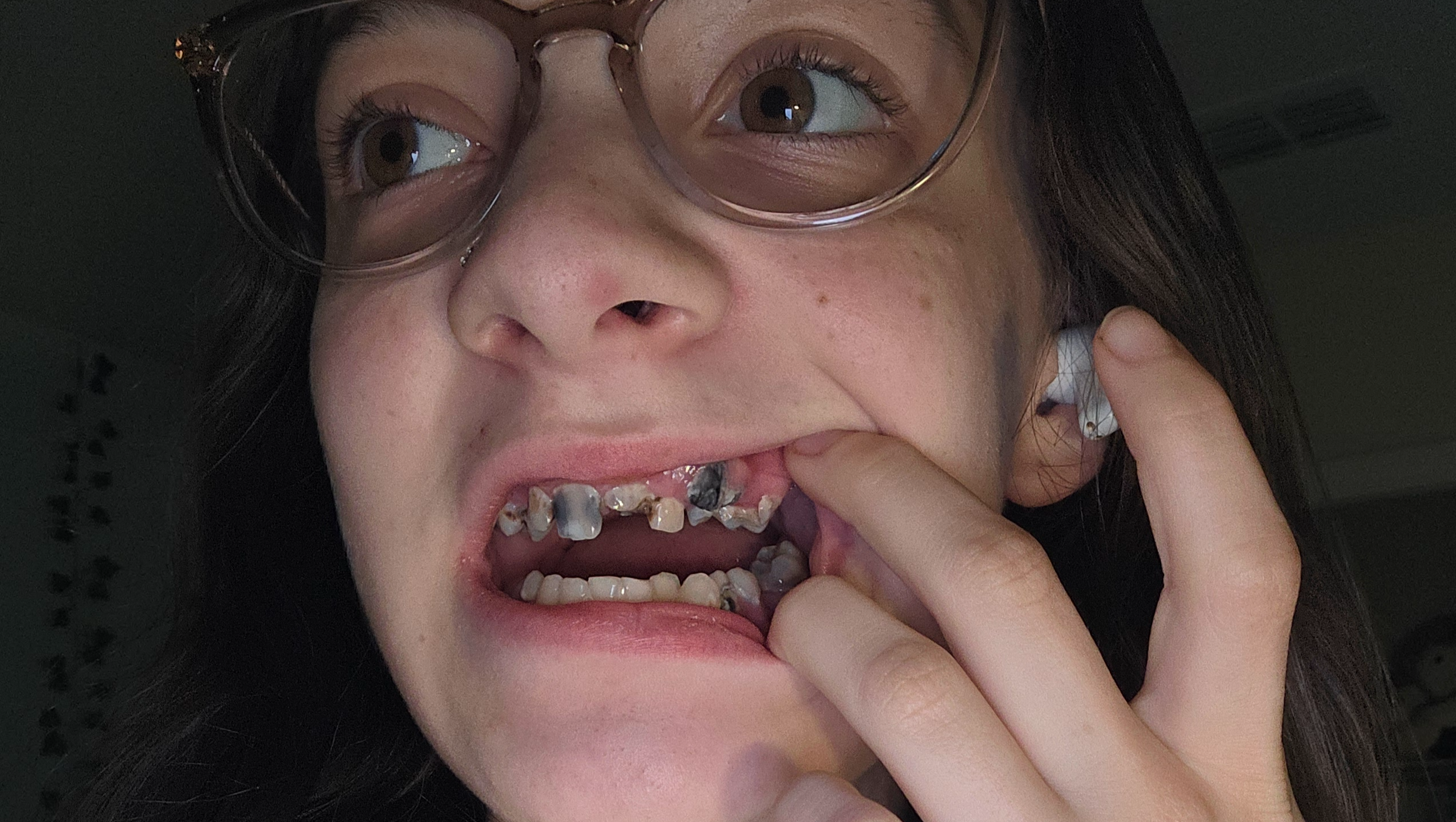 Help With My Urgent Dental Surgery photo