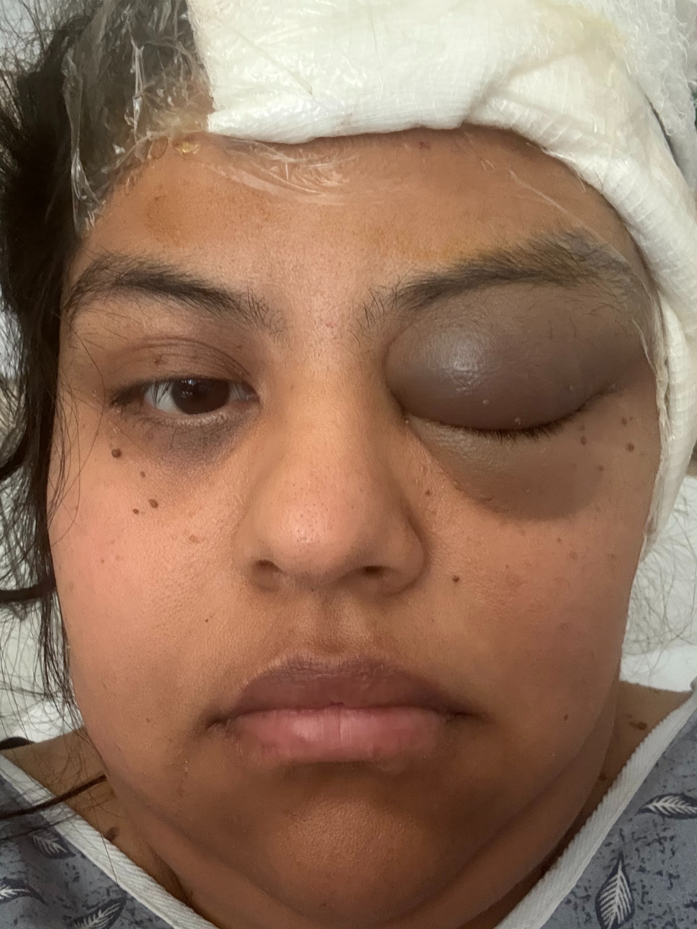 Help Laura Fight Her Brain Tumor campaign photo, 4 of 7
