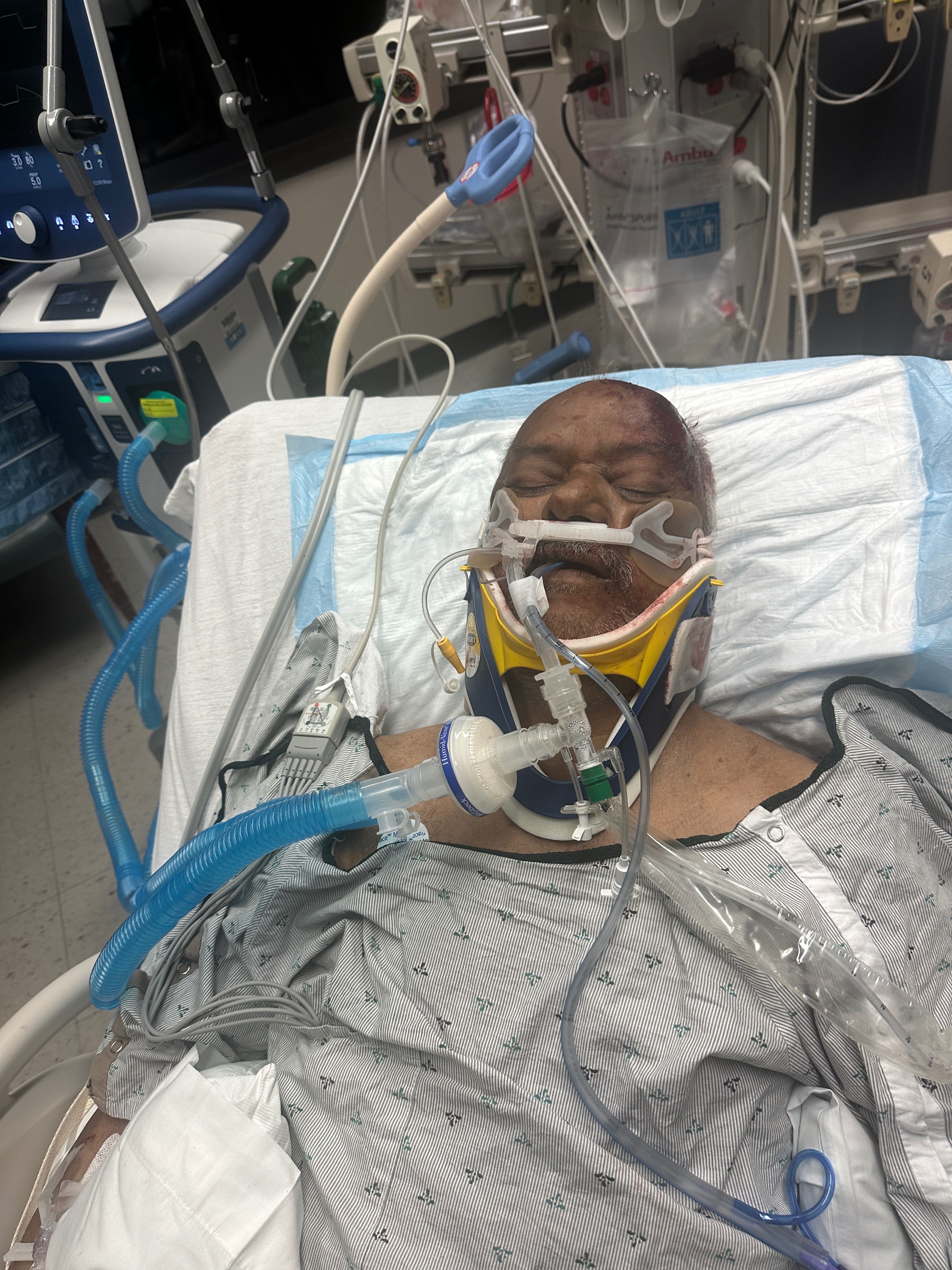 Support my dad for recovering from critical injury campaign photo, 5 of 6