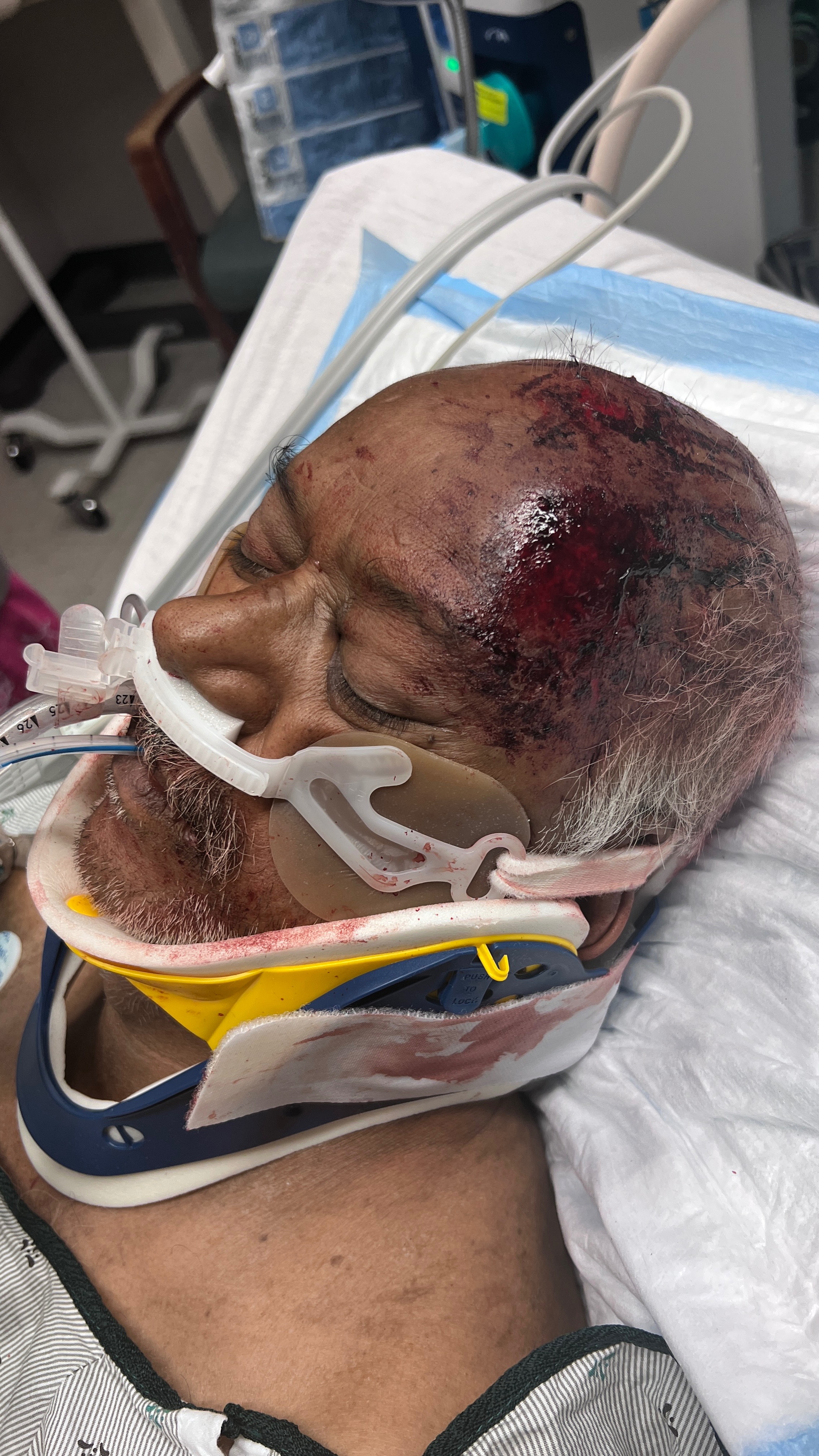 Support my dad for recovering from critical injury campaign photo, 2 of 6