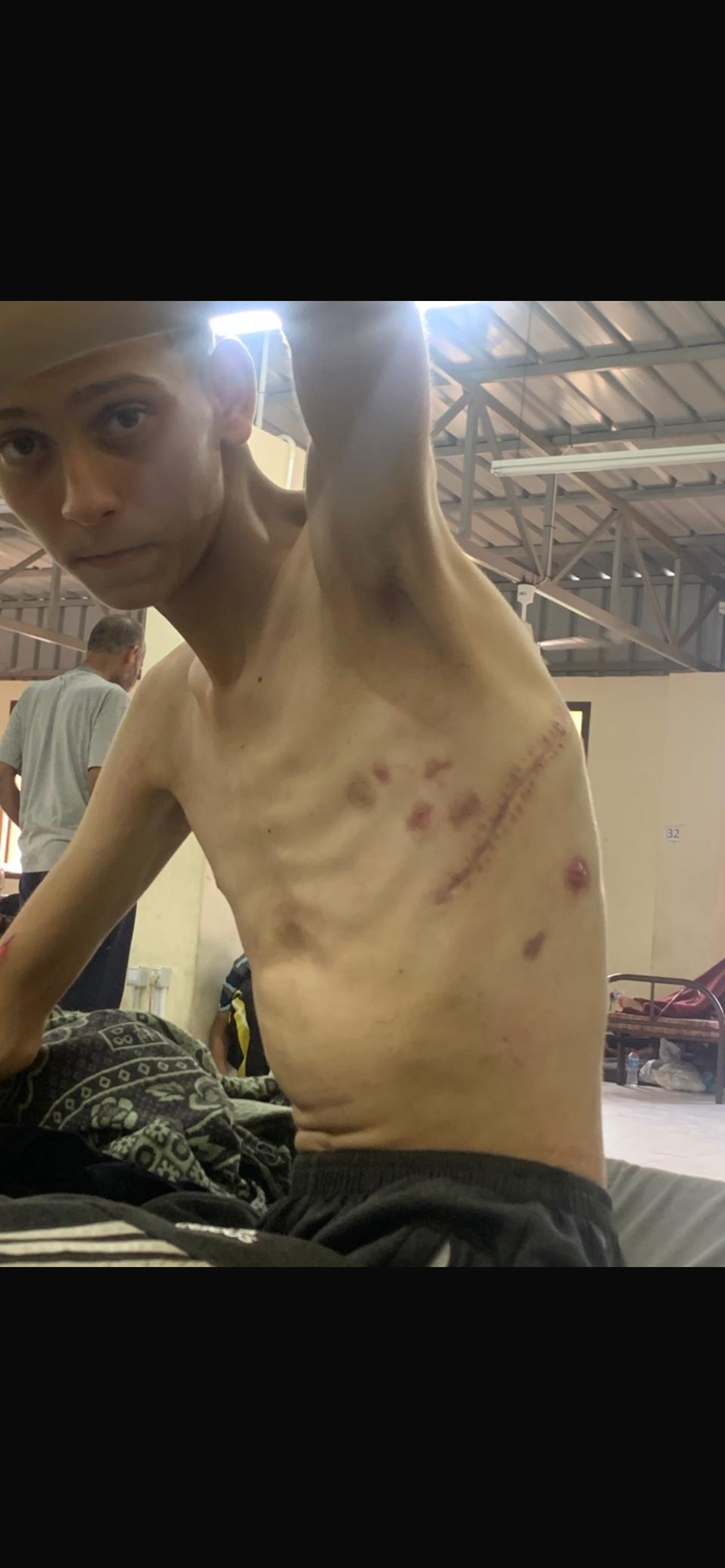 Please help Aed from Gaza get the medical treatment he needs campaign photo, 2 of 8