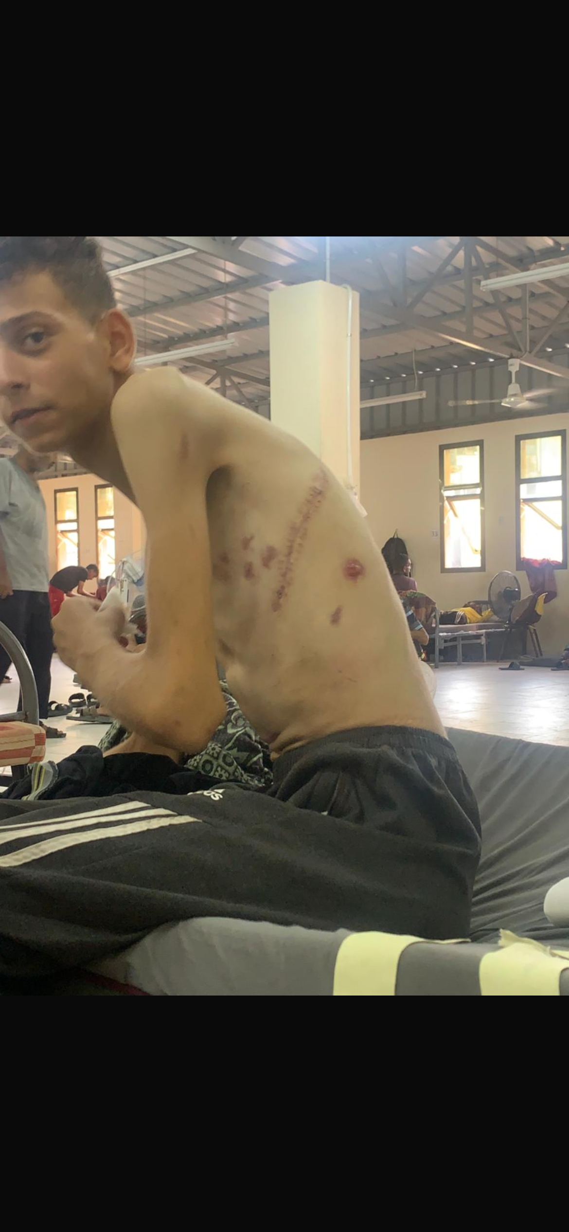 Please help Aed from Gaza get the medical treatment he needs campaign photo, 4 of 8