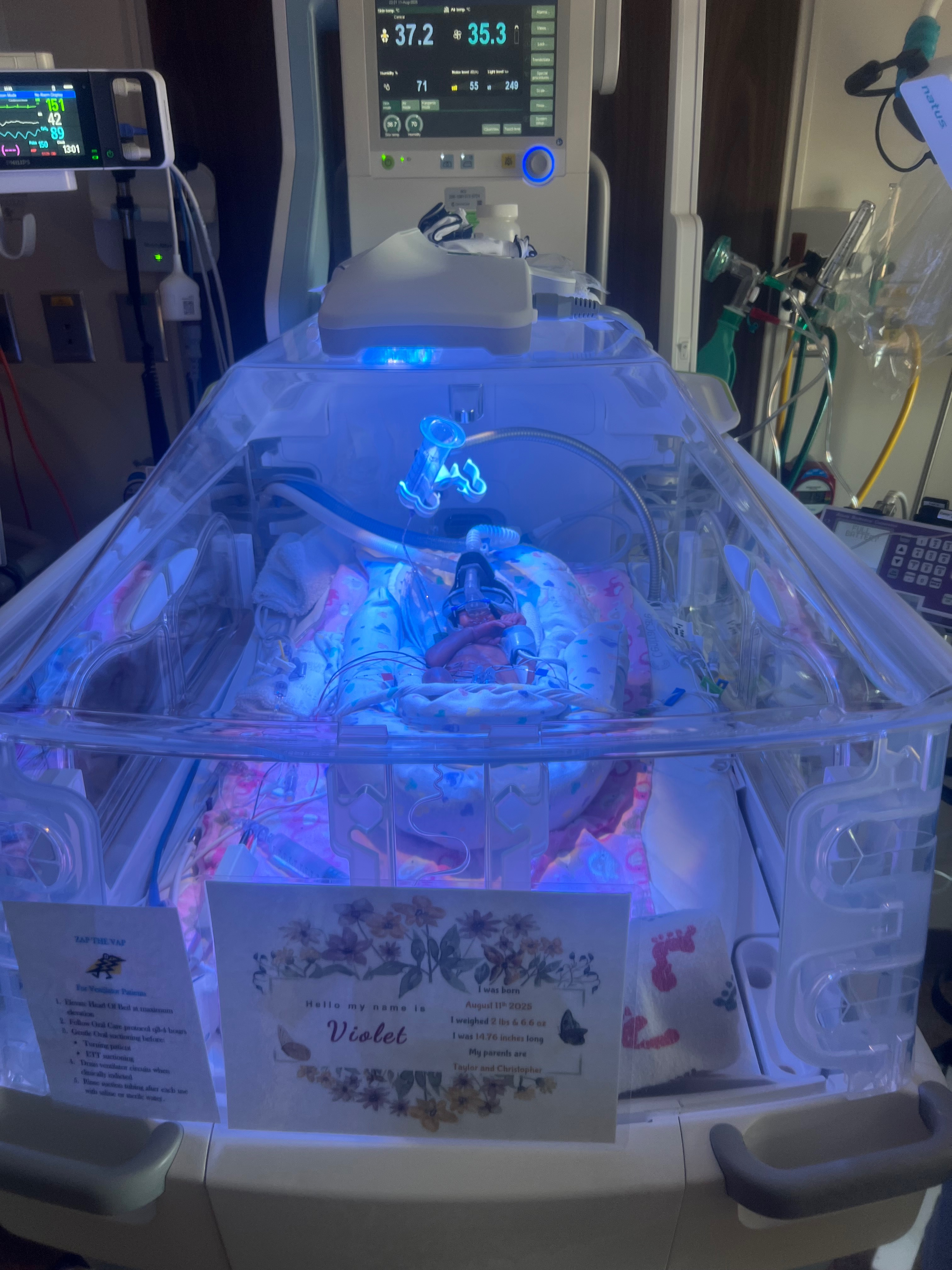 Support Baby Violet's NICU Journey campaign photo, 5 of 8