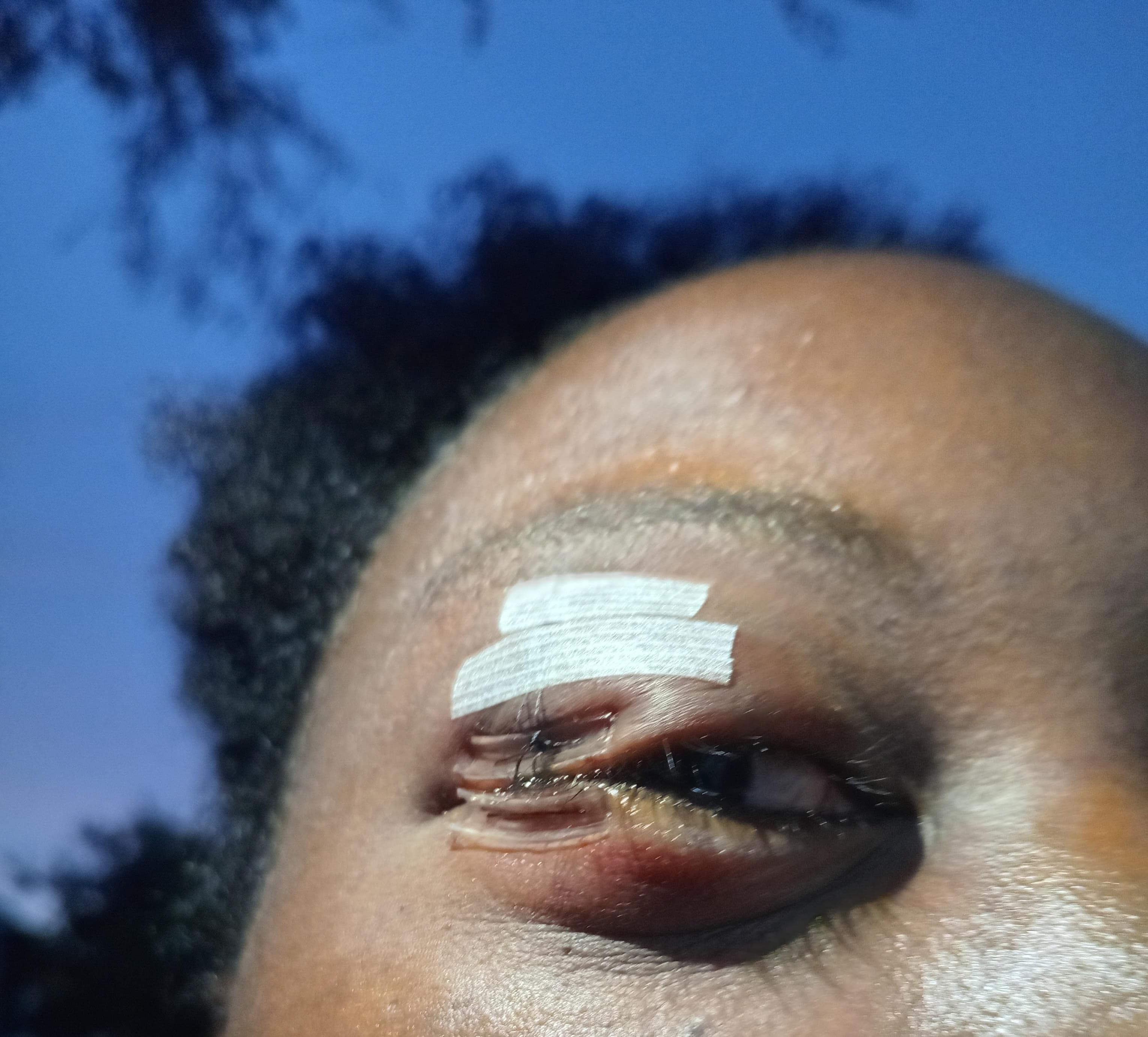 Help Ashlee Save Her Sight campaign photo, 5 of 6