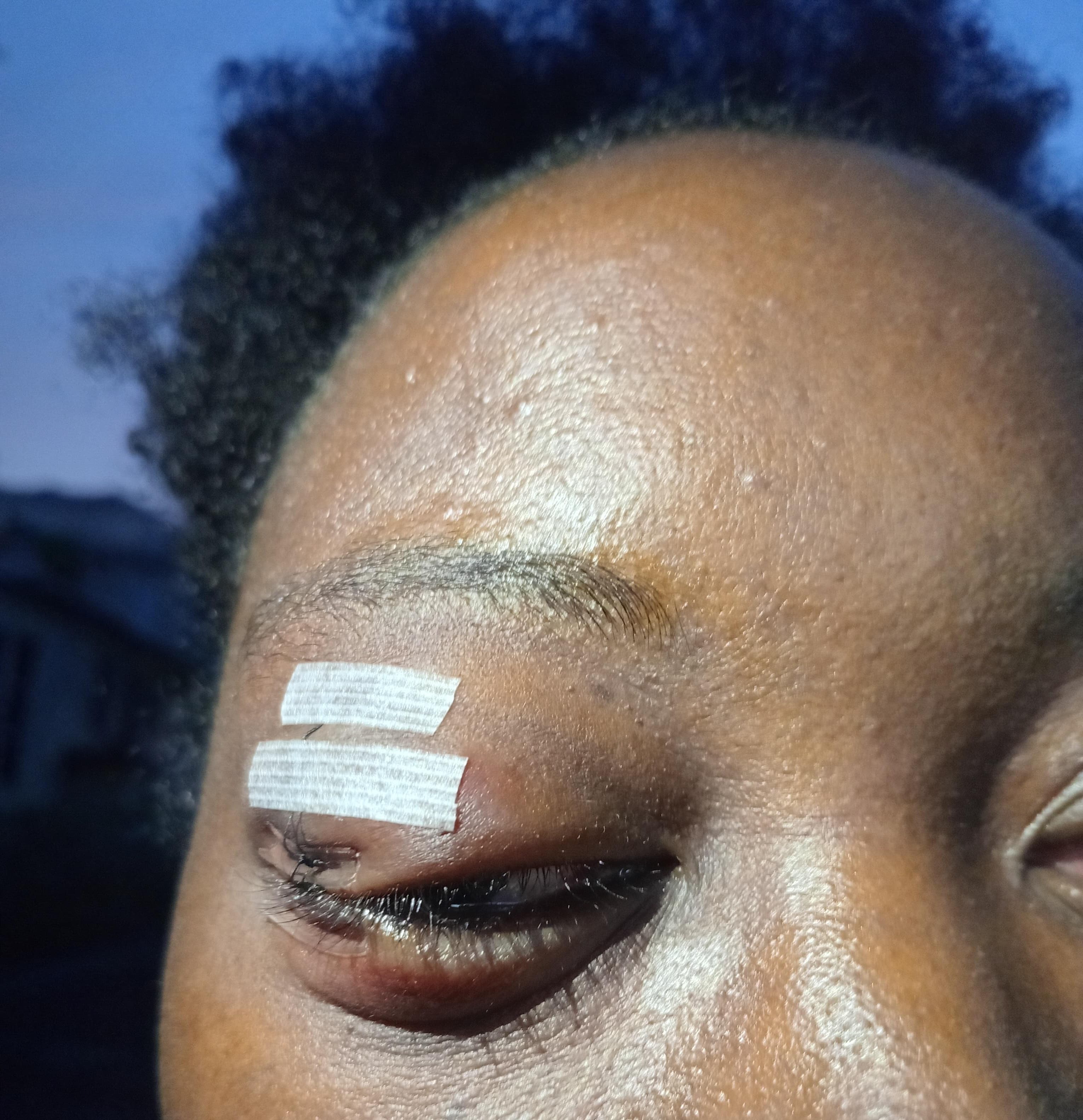 Help Ashlee Save Her Sight campaign photo, 2 of 6