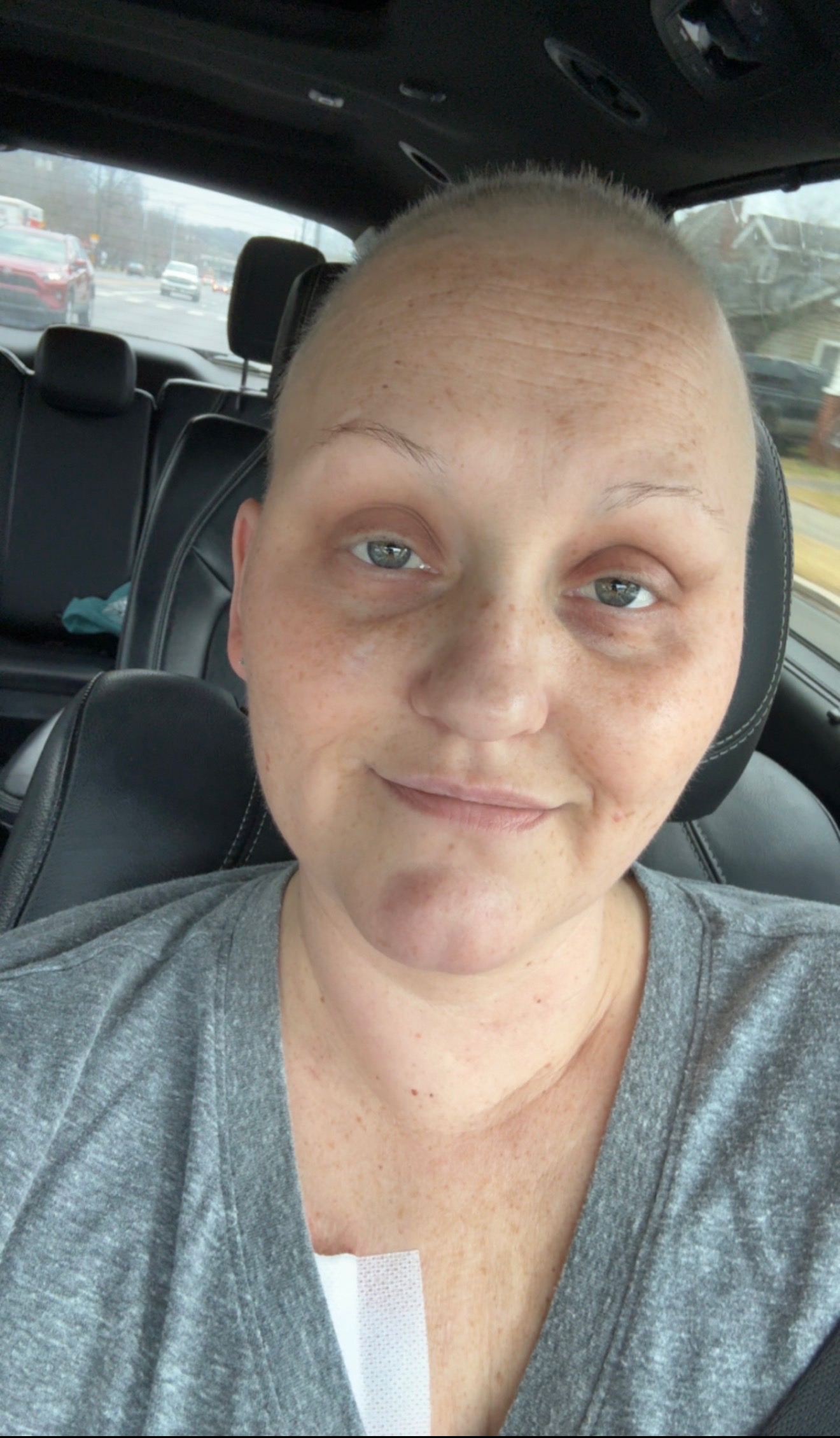 Support Kayla's Fight Against Breast Cancer campaign photo, 4 of 6