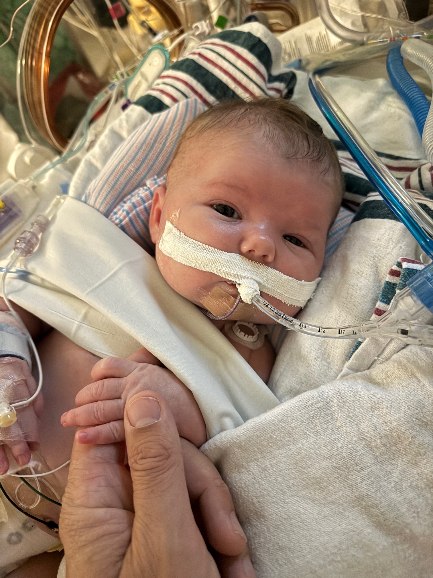 Support Baby Winifred's Heart Surgery campaign photo, 7 of 8