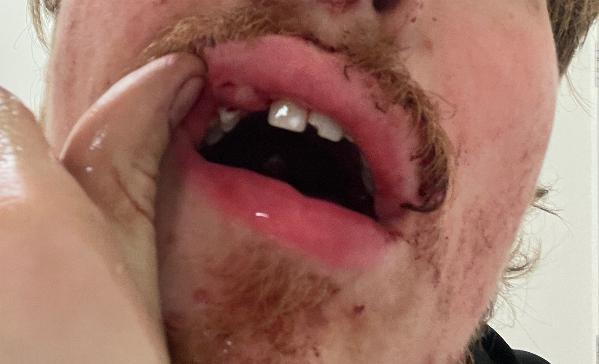 Help "Toofless" Get Back into the Fight campaign photo, 6 of 8