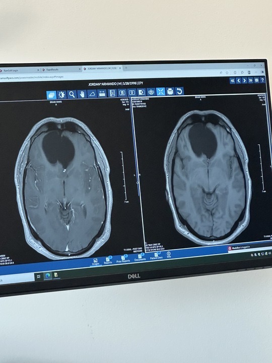 Armando's Brain Surgery: Help Ease the Burden campaign photo, 6 of 8