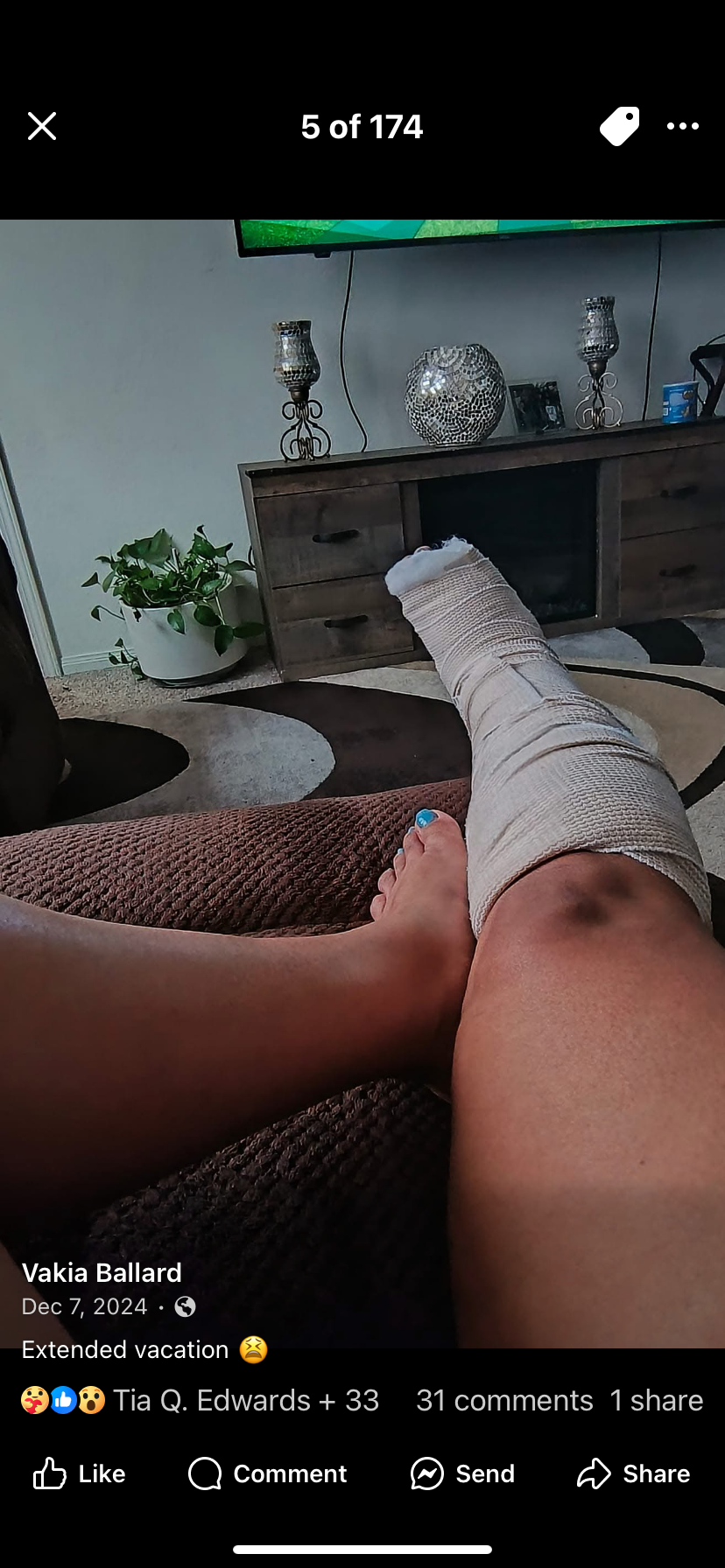 Mom's Home at Risk After Surgery Delay campaign photo, 2 of 5