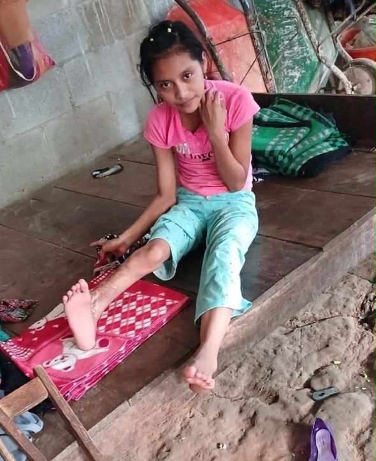 Help Bring Orthopedic Surgery to Children in Guatemala campaign photo, 2 of 8