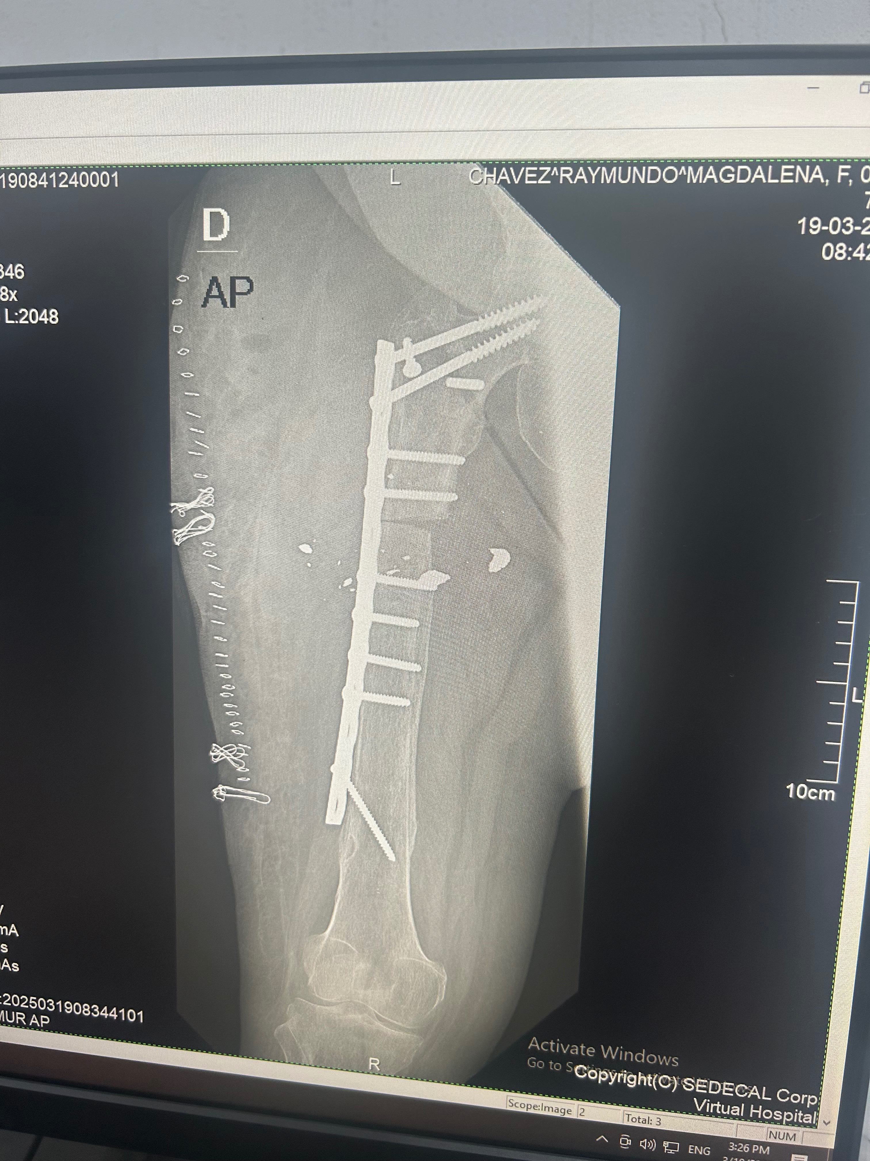 Help Bring Orthopedic Surgery to Children in Guatemala campaign photo, 5 of 8