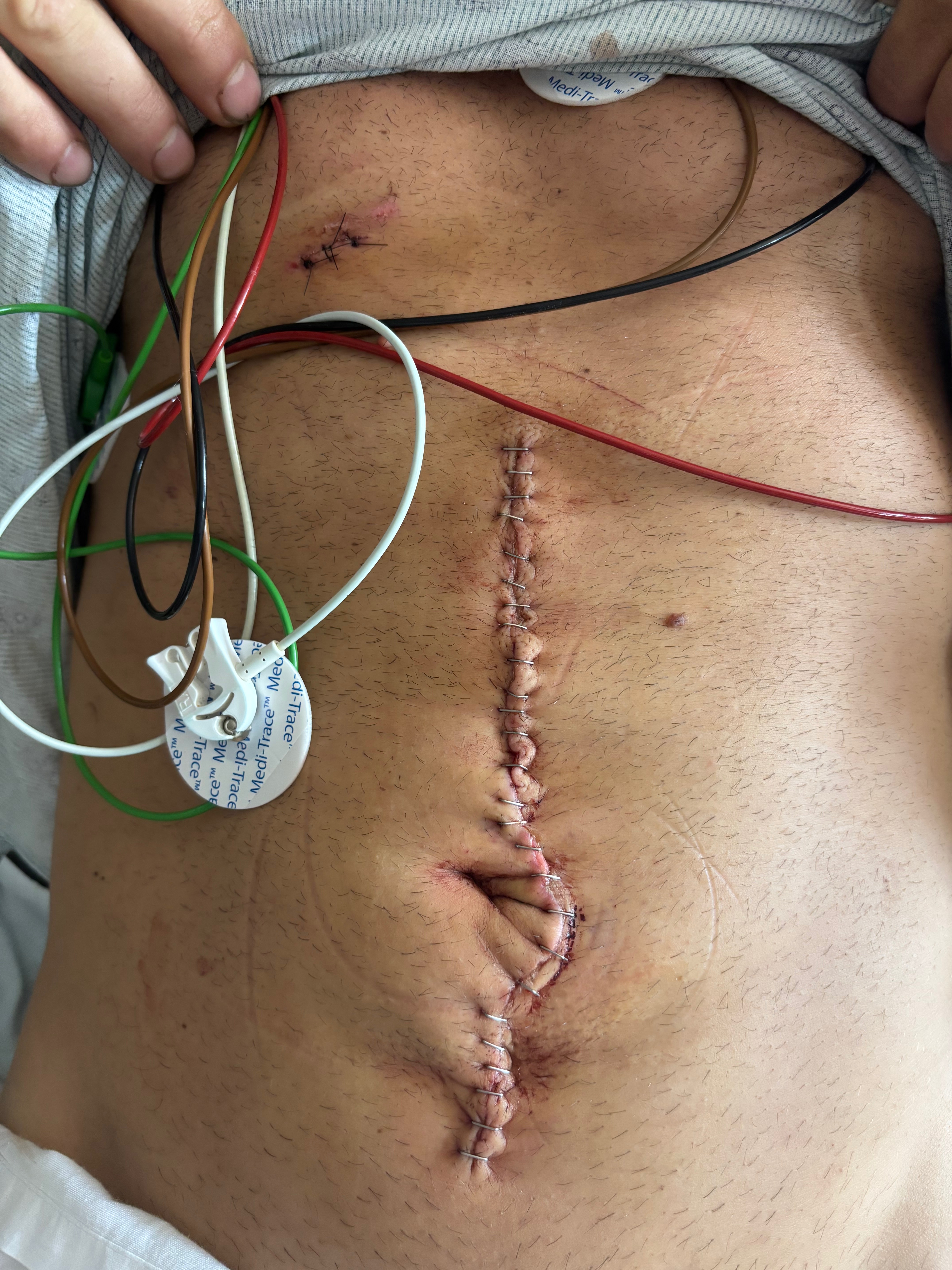 Help Michal Heal After Brutal Attack campaign photo, 5 of 8
